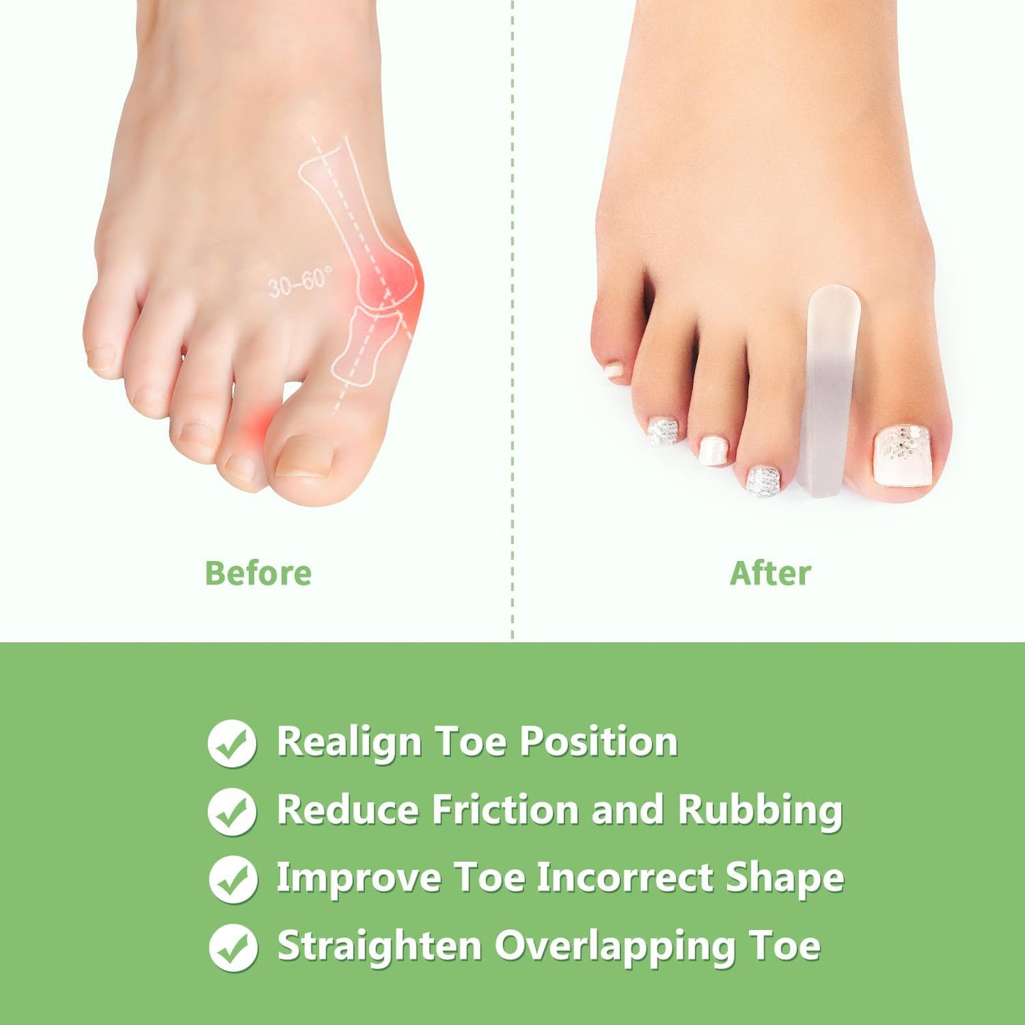 Niupiour Silicone Big Toe Separator for Bunion, 10 Pack- Large Toe Spacer for Women and Men, Flared Design Toe Straightener for Aligning Toes and Correcting Toe, Prevent Blisters, Calluses and Corns