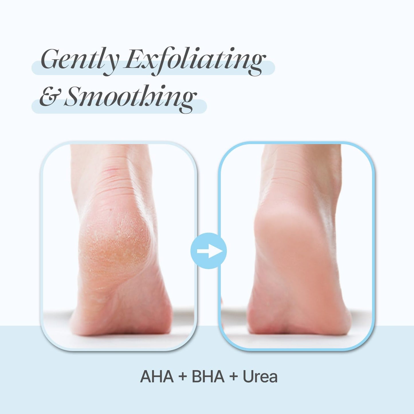 PETITFEE Rose Petal Satin Heel Mask (5pairs) - Moisturizes & Softens Dry and Cracked Heels, Rose Scented Heel Repair Masks with Shea Butter, Urea, BHA, AHA for Smooth Heels, Heel Treatment