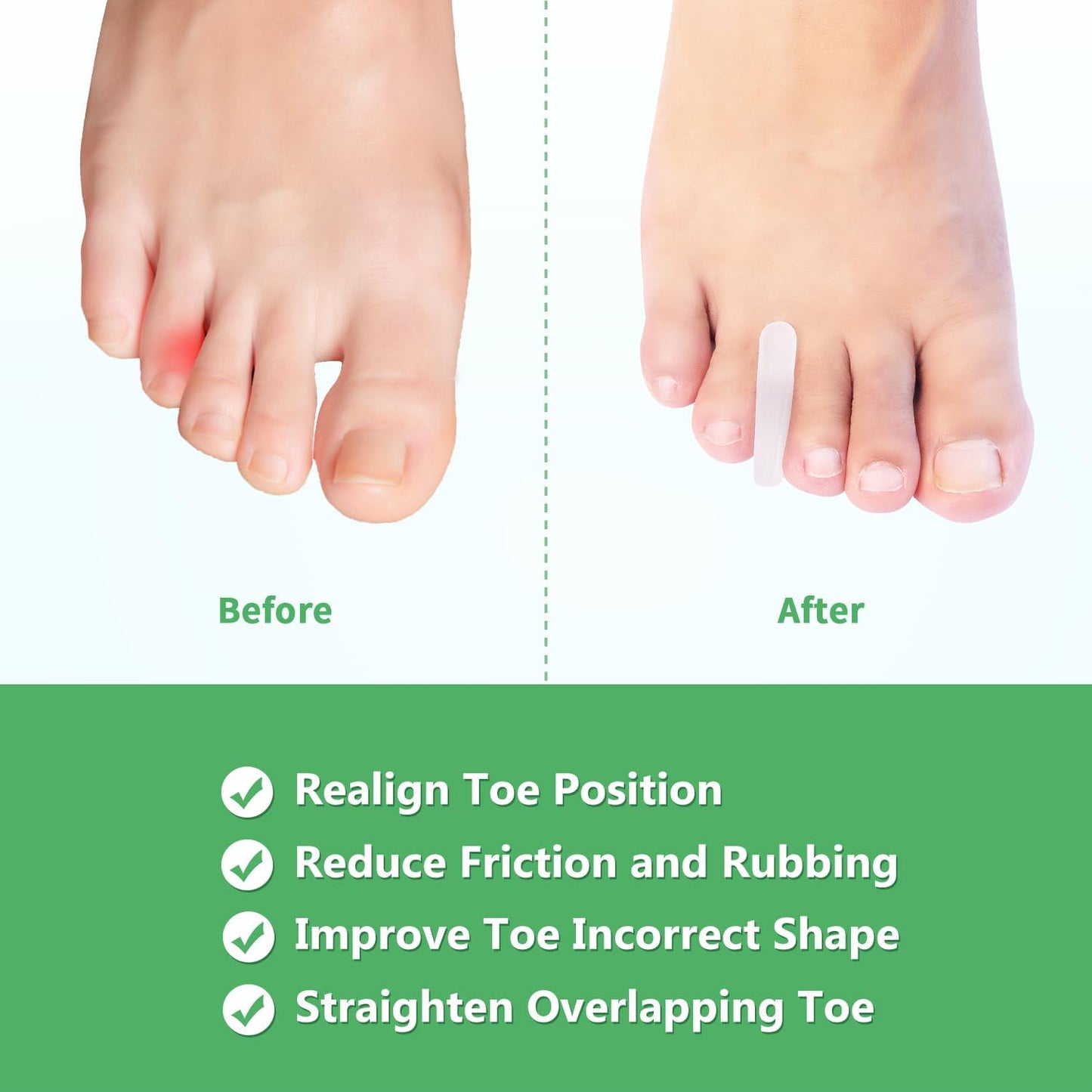 Niupiour Medium Toe Separator for Bunion, 10 Pack- Small Silicone Toe Spacer for Women and Men, Flared Design Gel Toe Straightener for Aligning Toes and Correcting Toe, Relief Foot Pain