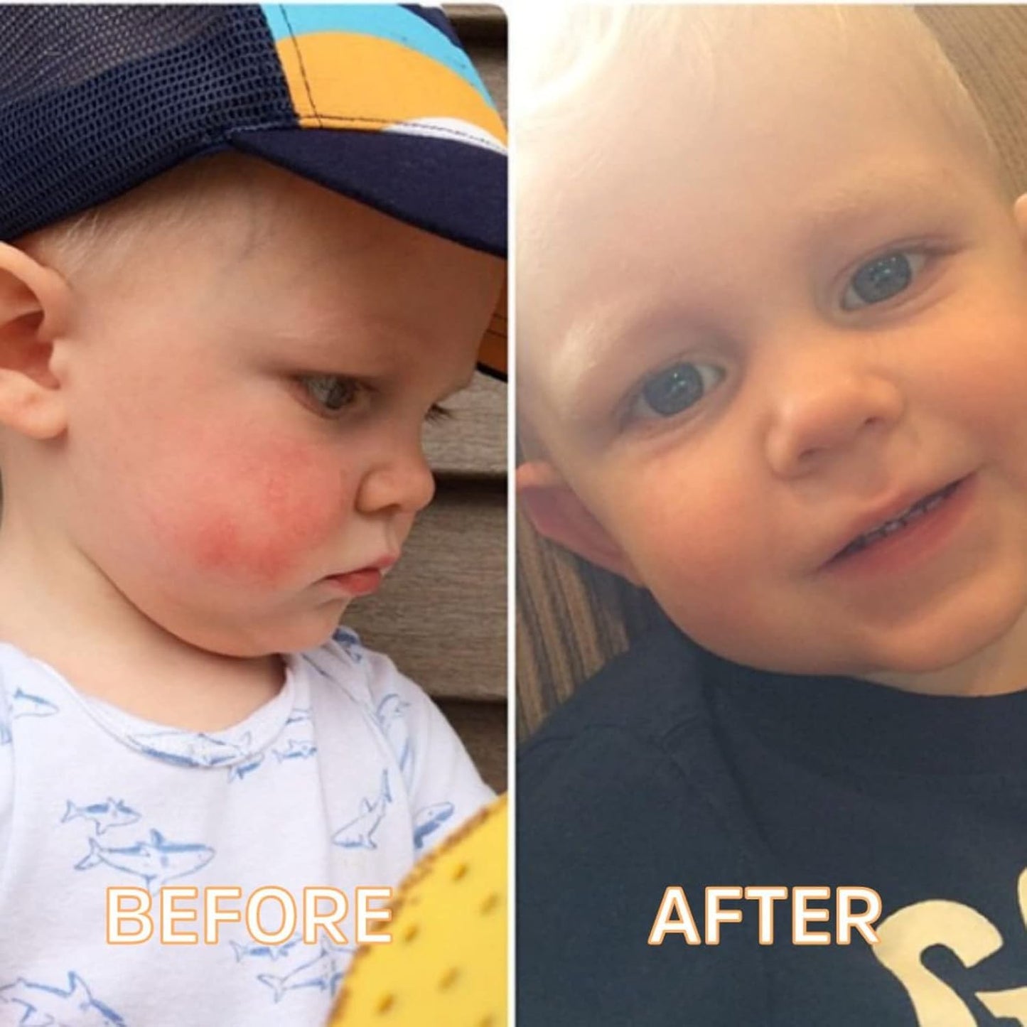 FATCO Fat Stick and All Purpose Baby Moisturizing Stick for Diaper Rashes, Dry Skin, and Chapped Lips - Unscented (0.5 oz)