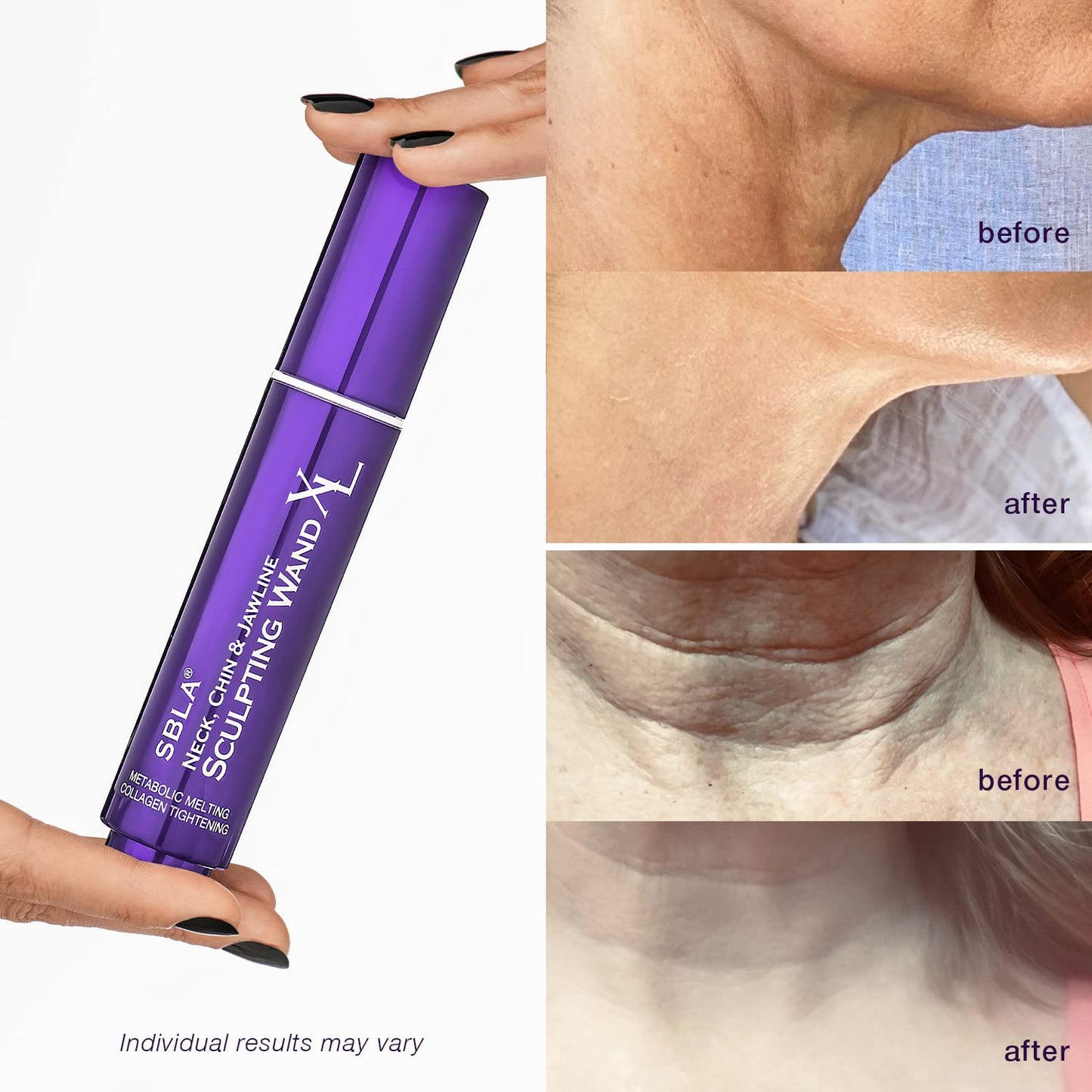 SBLA Neck, Chin & Jawline Sculpting Wand XL – Melts Neck Fat Under The Chin & Along Jowls, Lifts & Sculpts The Entire Area & Reduces Lines, Boosts Collagen Production