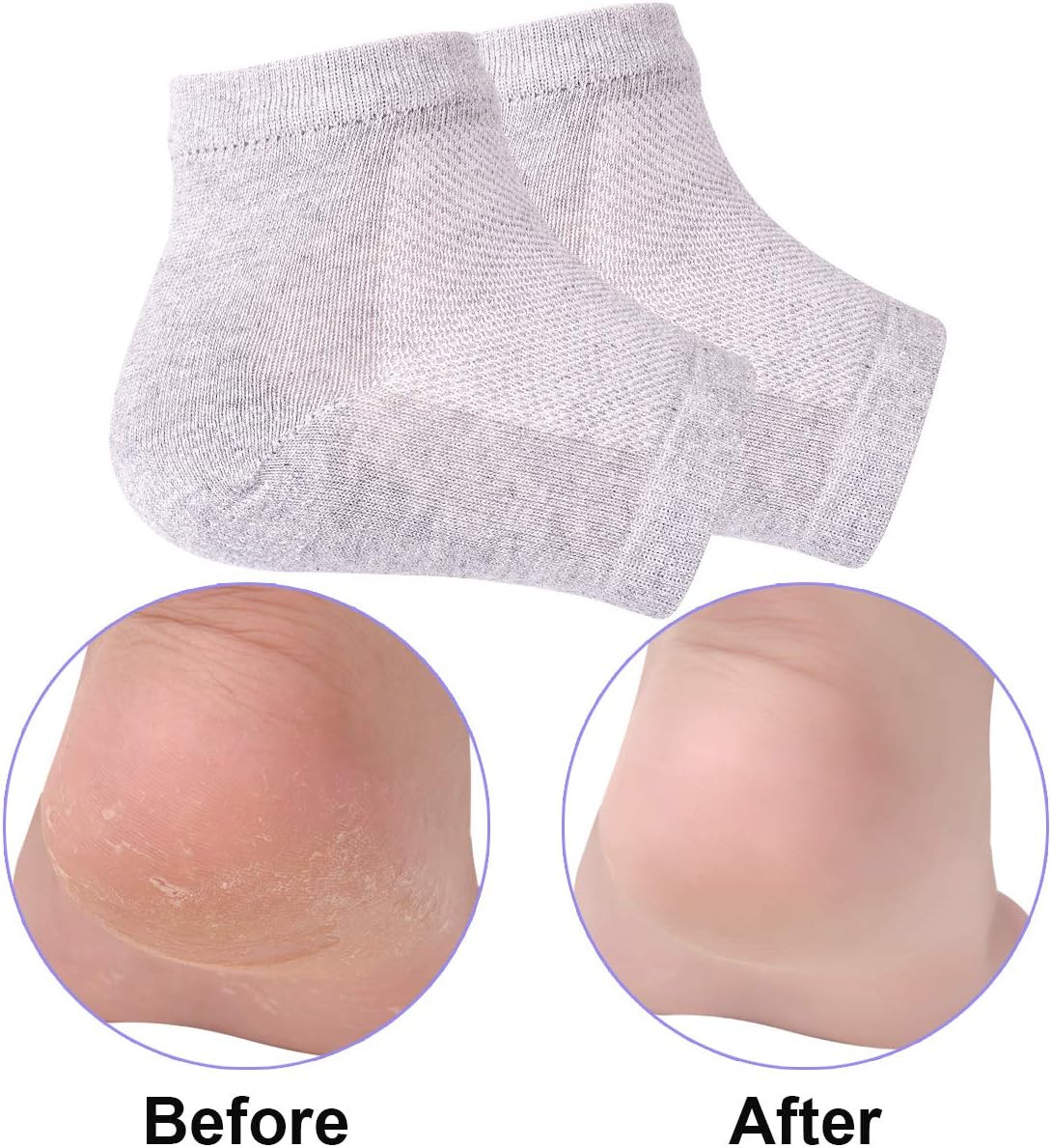 Vented Moisturizing Gel Heel Socks, 3 Pairs Toeless Spa Sock for Foot Care Treatment, Cracked Heels, Dry Feet, Foot Calluses (Grey)