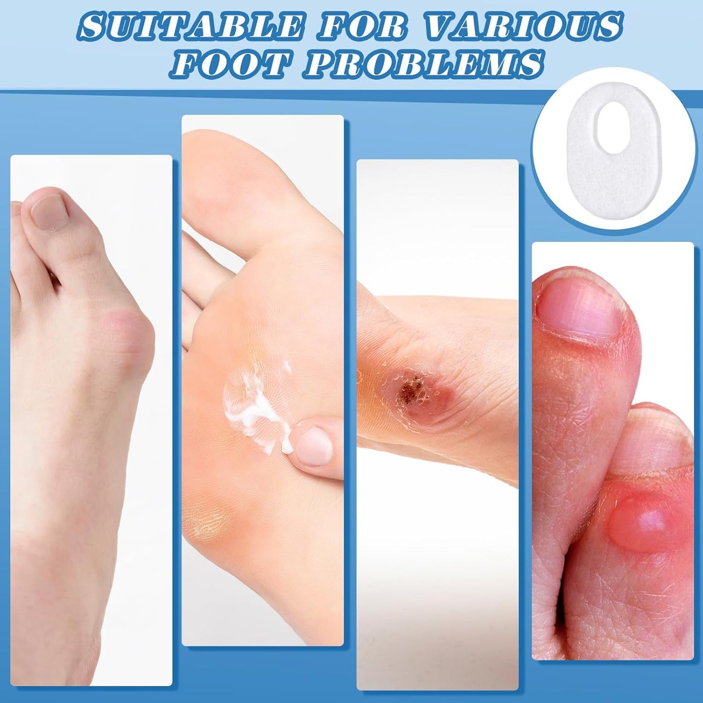 WILLBOND 30 Pcs Callus Pads Soft Felt Callus Oval Shape Corn Pads for Bottom of Foot Adhesive Foot Corn Cushion for Men and Women Feet Toes Heel Pain Relief (White)