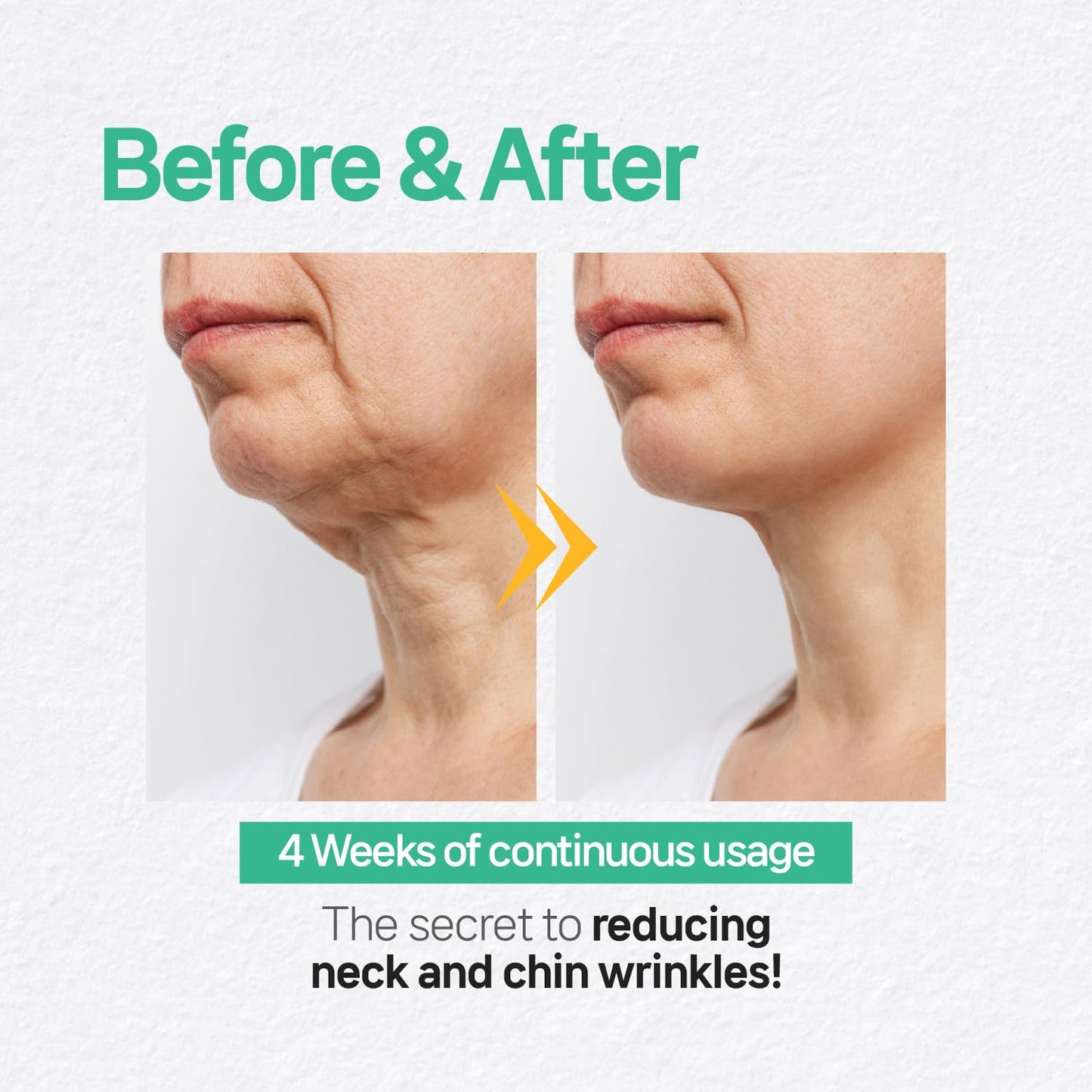 Labottach V Line Face & Neck Lifting Hydrogel Patches – 4pcs Collagen Mask for Jawline Contouring, Neck Wrinkle Care, Firming & Anti-Aging with Hyaluronic Acid and Vitamin E