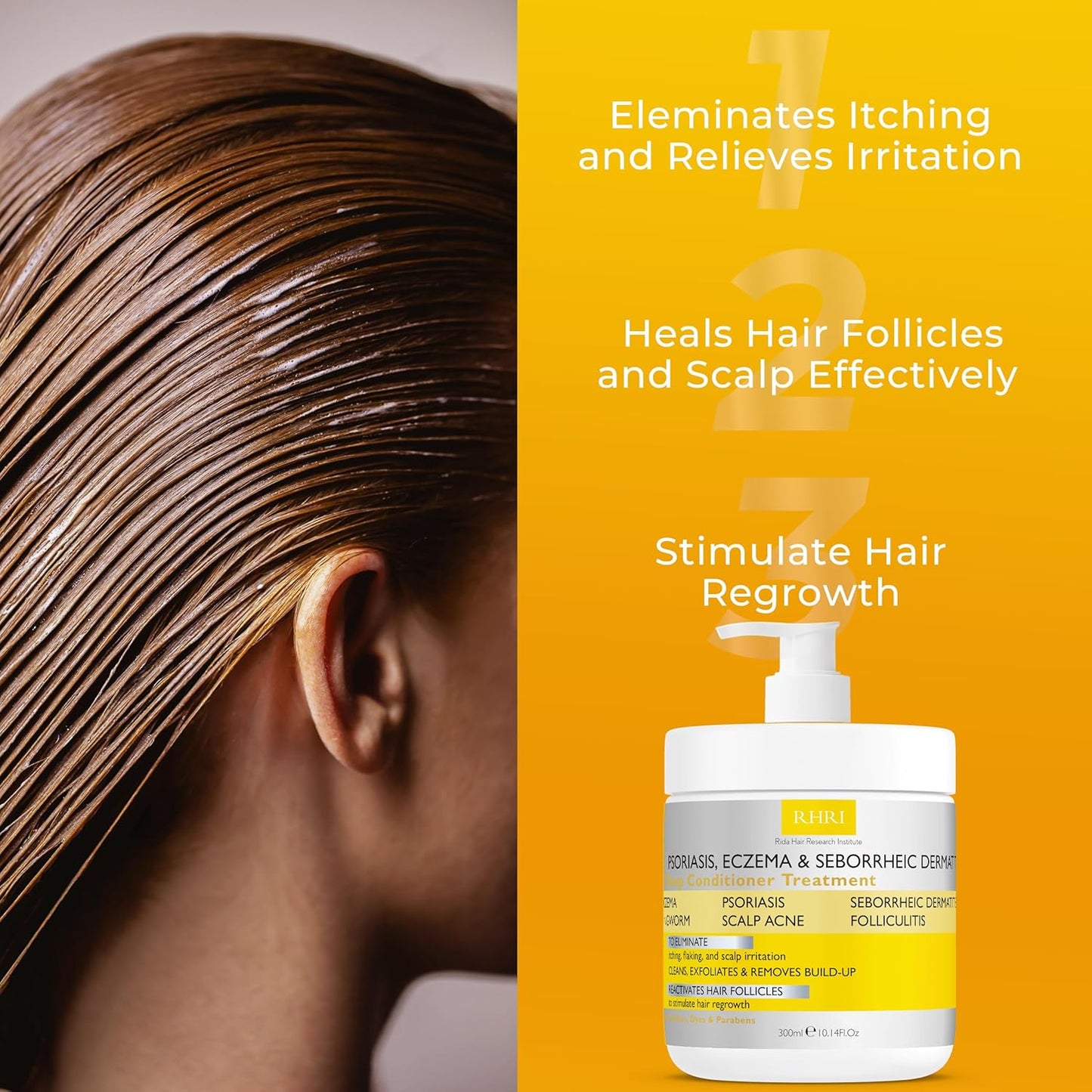 Anti Fungal Psoriasis Conditioner for Psoriasis, Eczema & Seborrheic Dermatitis | With DHT Blockers, Mineral Complex & Tea Tree Oil | Soothes Dry Itchy Scalp & Supports Hair Growth for Men & Women