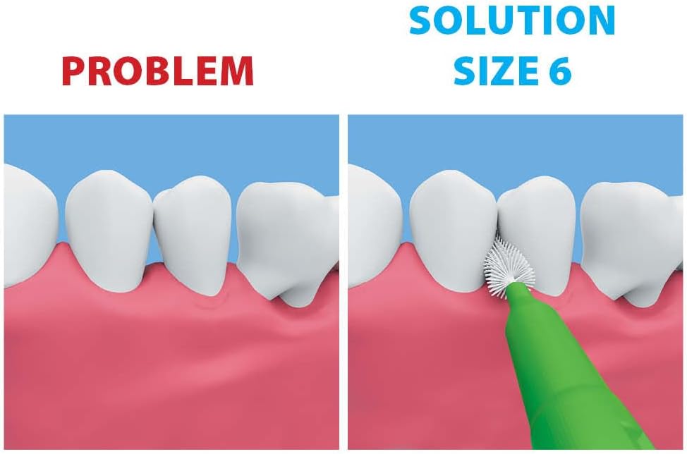 Piksters Interdental Brushes, Size 6, 100 Count (10 x 10 Packs), Interdental Tooth Brush for Larger Gaps, Gum Soft Bristles for Plaque Removal, Safe for Braces (100pk)