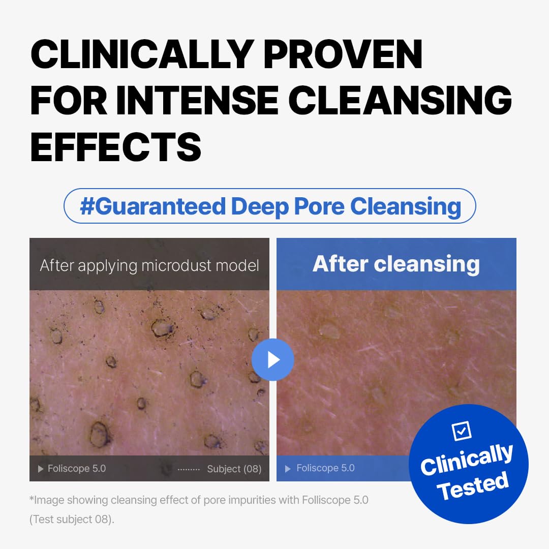 MAKE P:REM Safe Me. Amino Refresh Cleansing Balm, Gentle Makeup Remover for Deep Cleansing, Removes Blackheads, Eye-Safe Cleanser, Korean Skin Care, 3.38 Fl Oz, 100ml