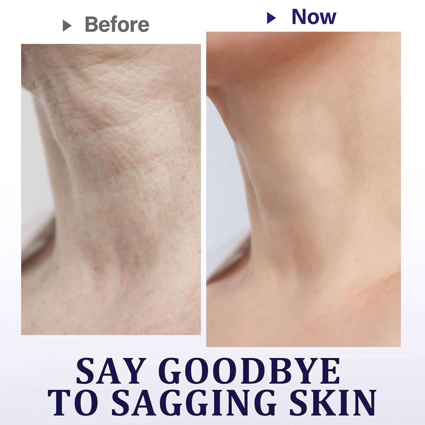 Neck Wrinkle Patches, 5PCS Anti Wrinkle Collagen Tapes Firm and Moisturize Skin for Neck, Natural Plant Extract Formula Improve Fine Lines and Dullness