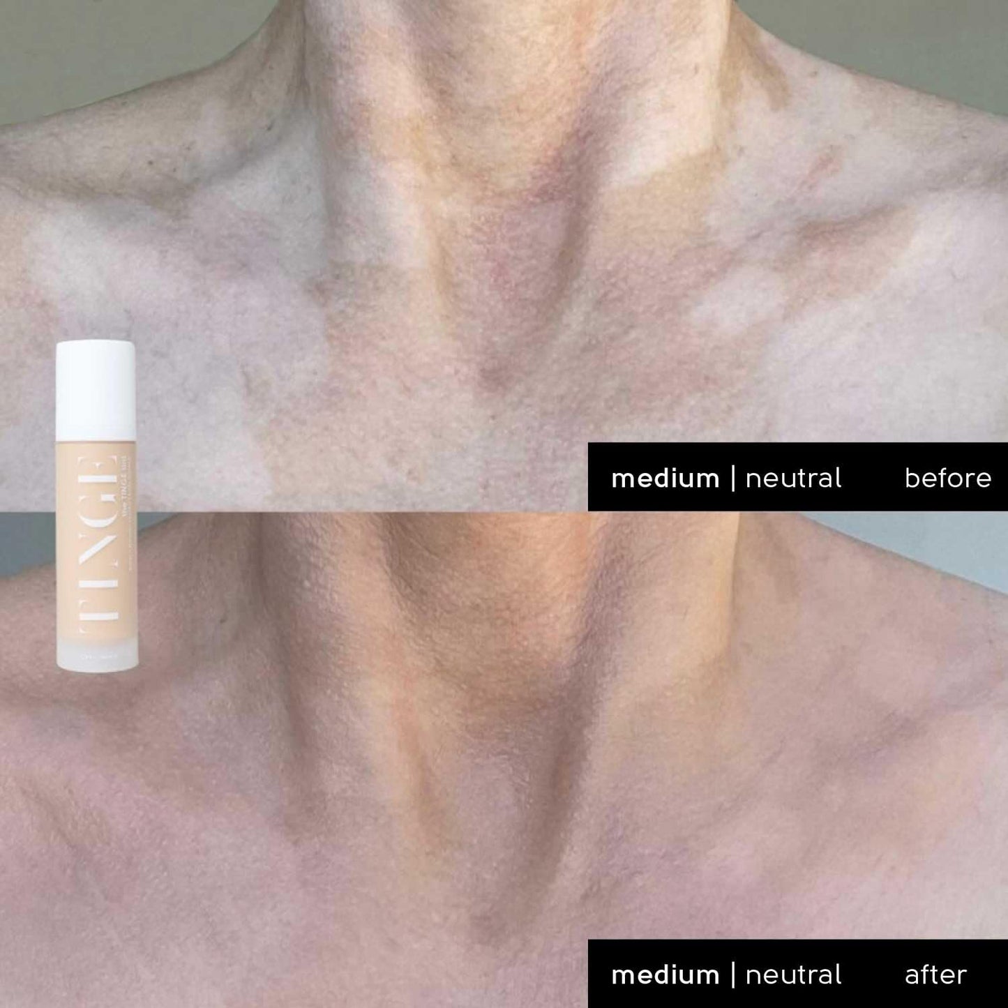 Tinge Tint Body Makeup, Up to 48 Hours, Medium Coverage Cream With Amino Acids, Hyaluronic Acid & Lysine, Semi Matte Finish, Water & Transfer Resistant, 3.38 Fl Oz Tube - Medium Warm