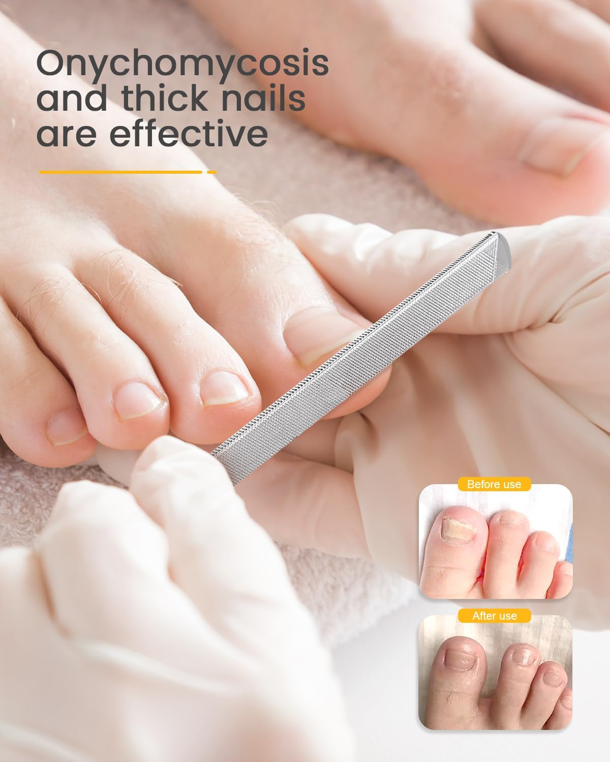 BEZOX Long Metal Nail File, Stainless Steel Fingernail File for Thick and Fungal Nails with Dual-Ended Toenail Lifter – The Ultimate Manicure & Pedicure Tool for Men and Women’s Nail Care - Black