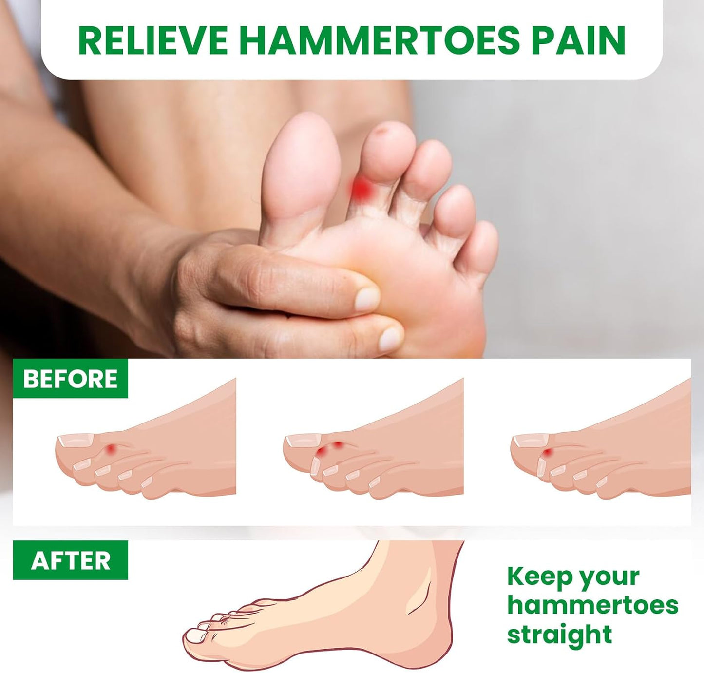 Bukihome Hammertoe Corrector - 6 Pack Toe Straightener to Curled Toes, Broken toe, Bunion Corrector for Women and Men, 3 Different Size (Clear)