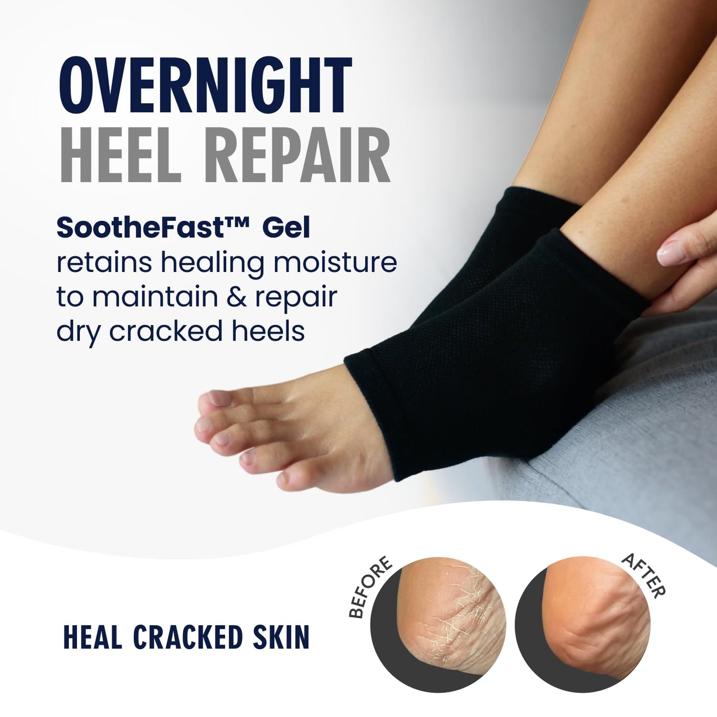 Dr. Frederick's Original Moisturizing Heel Socks for Cracked Heel Treatment - 2 Pairs - Socks for Dry Feet - Cracked Skin Repair & Overnight Hydration - Foot Care for Women & Men - Argan Oil