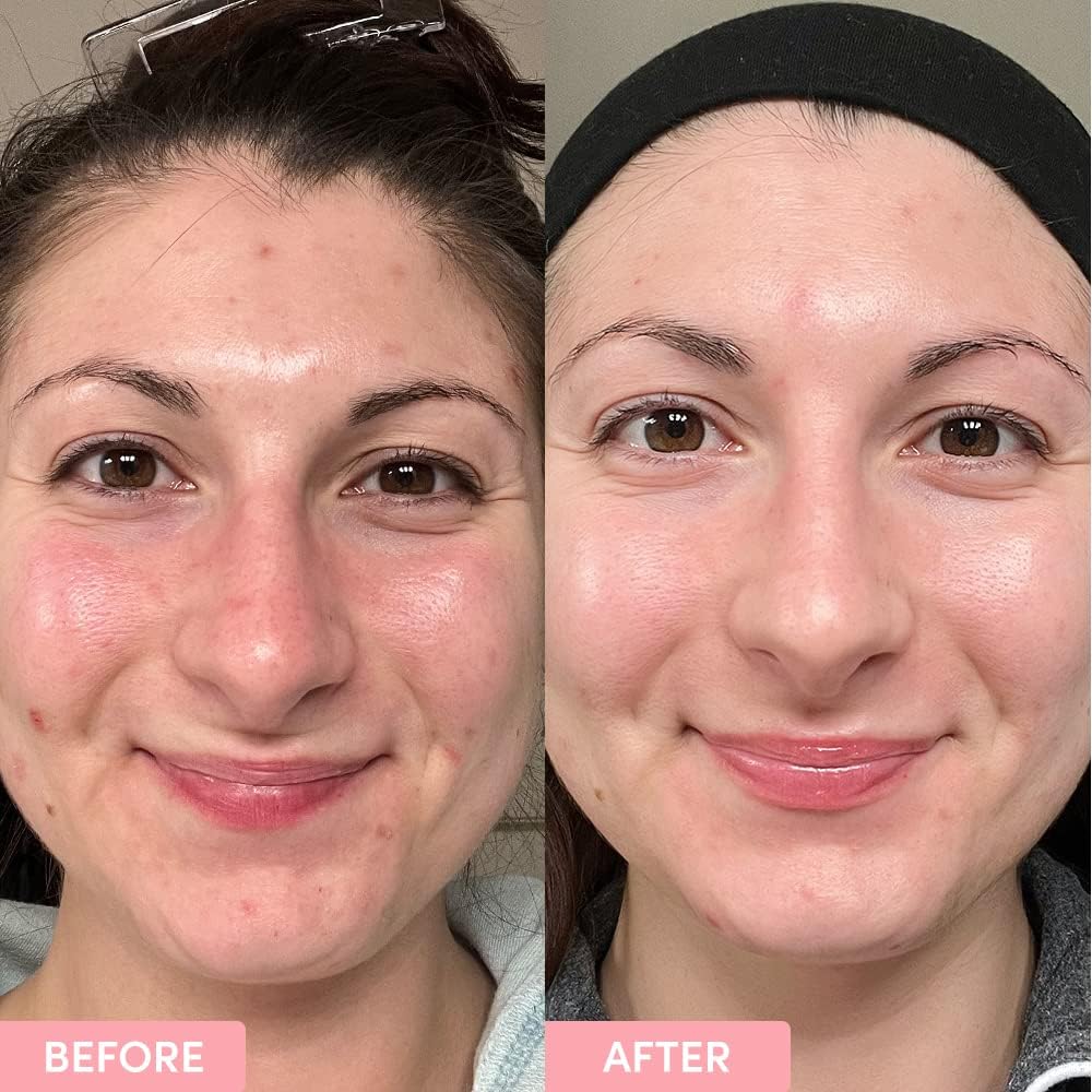 Sand & Sky Australian Essentials Brightening Toner with Niacinamide & Glycolic Acid - Marshmallow Extract Essence, Exfoliates & Strengthens Skin, 4.2 fl oz