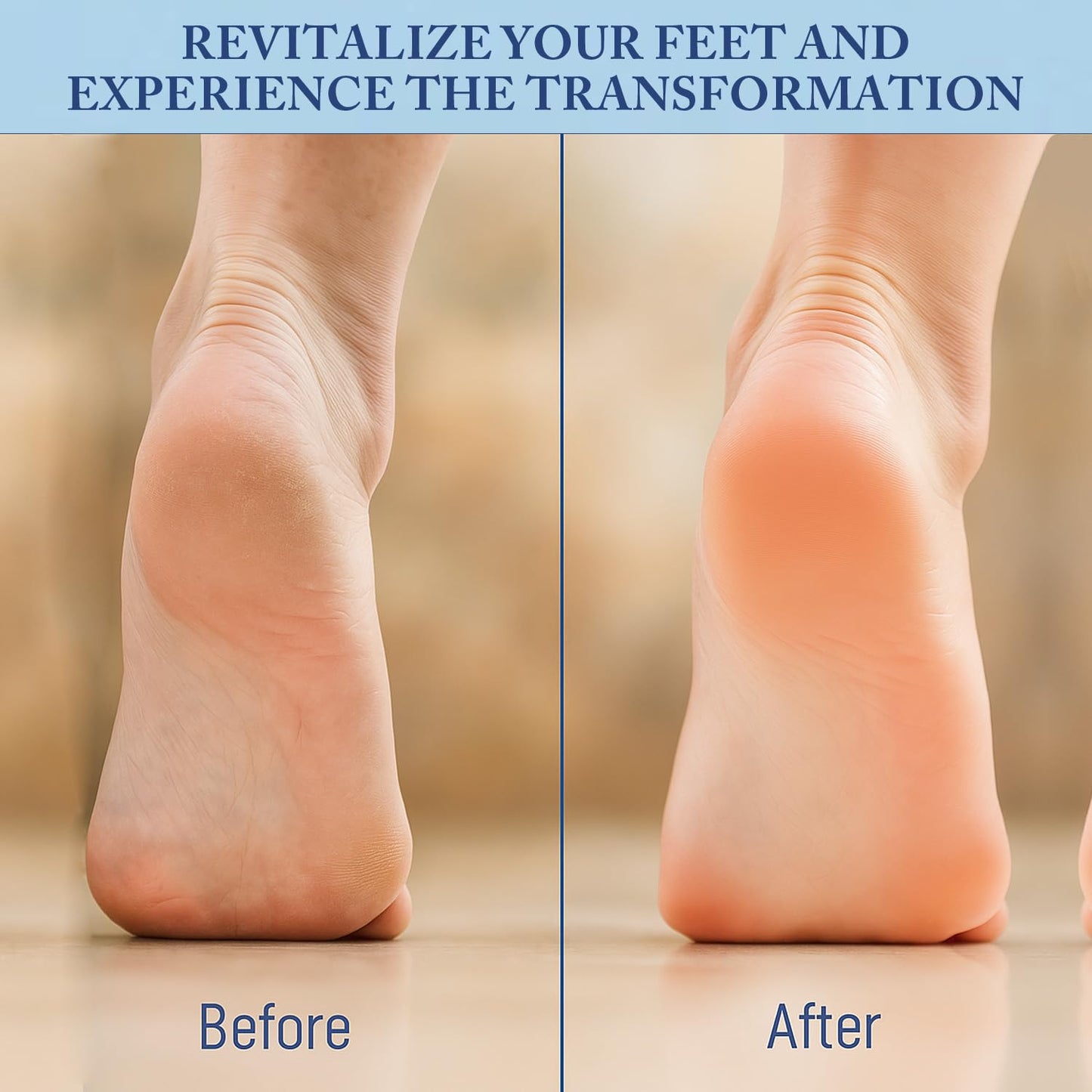 Tea Tree Oil Foot Cream Unscented with Eucalyptus Oil, Manuka Honey Natural for Feet Balm Moisturizing Instantly Hydrates & Soothes Irritated Skin & Athletes Foot Repair & Callus Remover 7 Oz