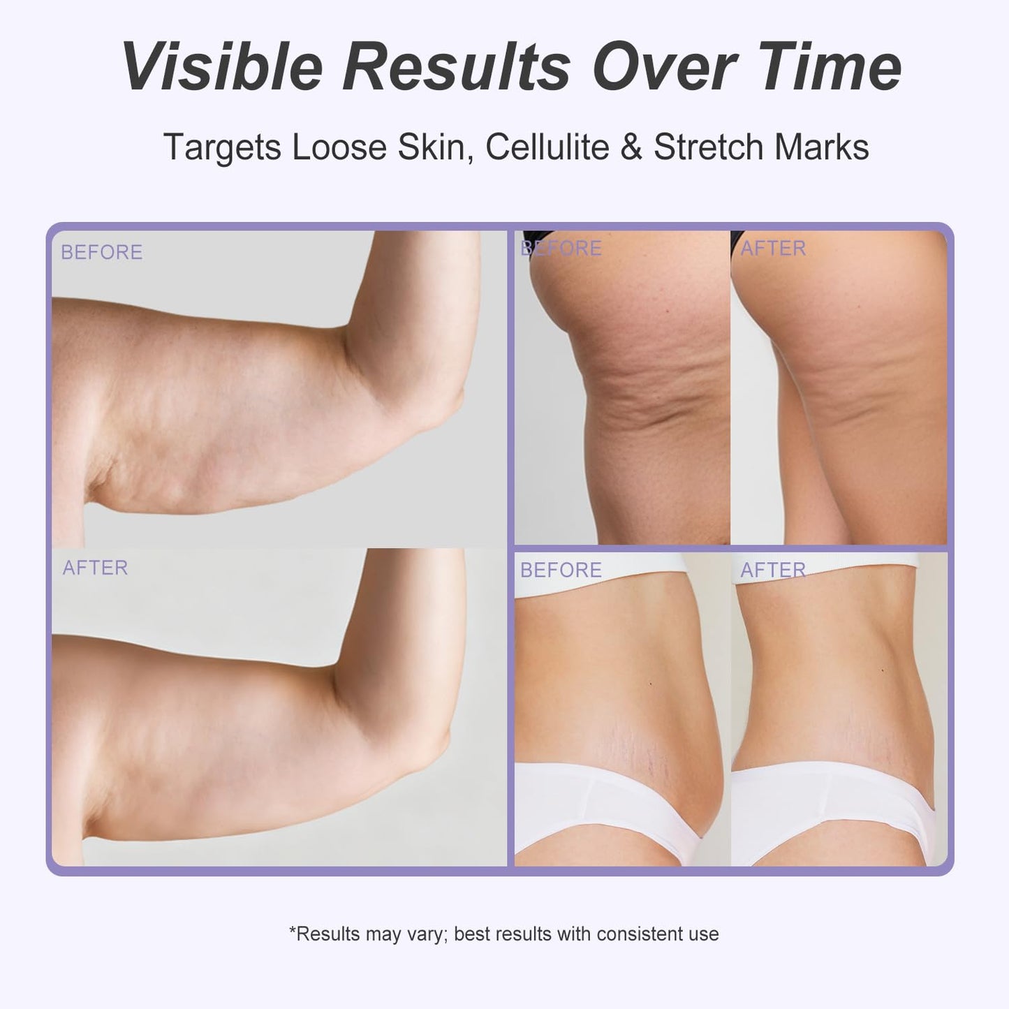 Dreamy Glow Overnight Toning Whip Cream – Anti Cellulite & Tightening Loose Skin for Body – LIFTONIN® Get Firming Cream with Satin Eye Mask 3.38 fl oz