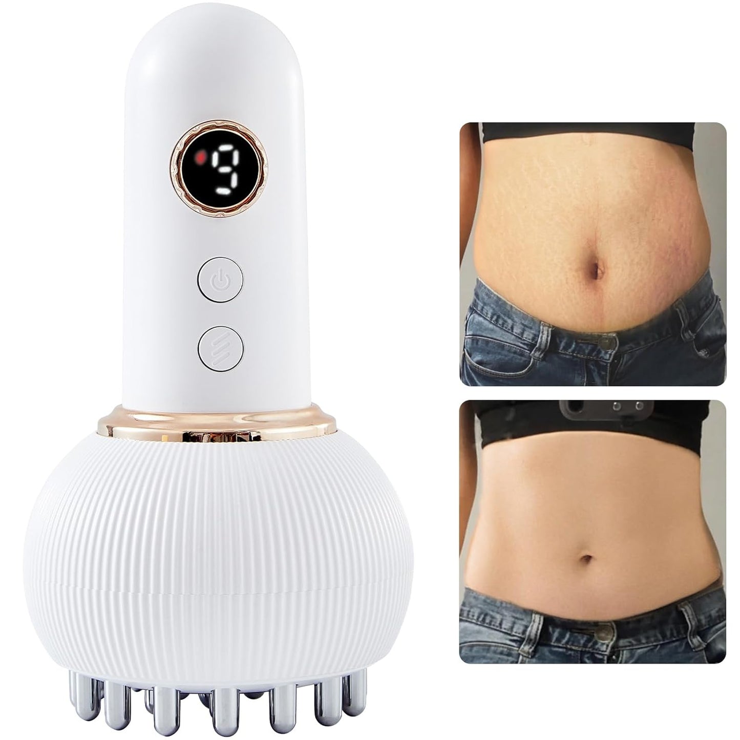 Lymphatic Drainage Massager & Anti Cellulite Massage Tool, Helps Reduce Stretch Marks & Cellulite, for Legs, Arms & Belly, Body Sculpting Machine with Microcurrent, Light, Heat & Vibration