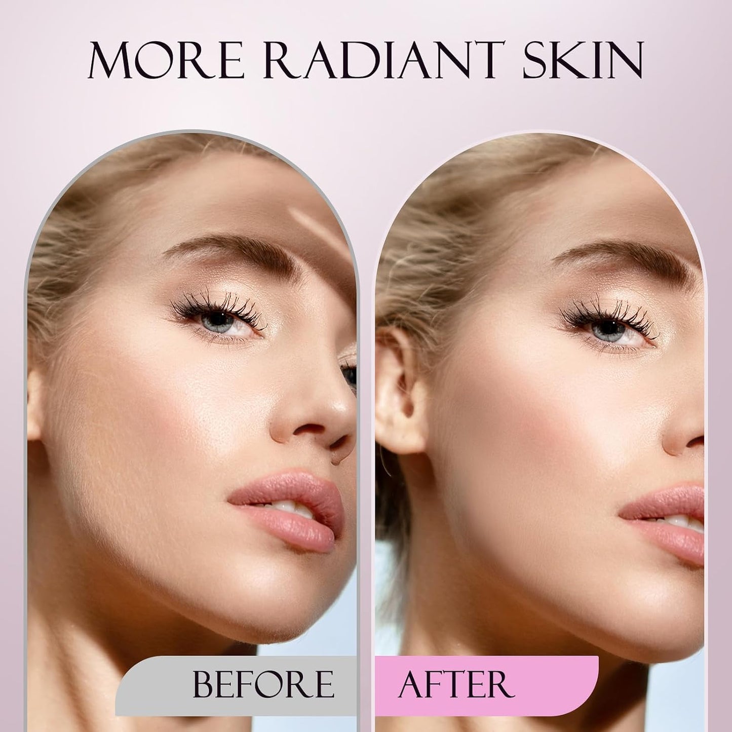 Sonic Dermaplane Razor for Women Face, Dermaplaning Tool for Face, Sonic Edge Technology, Facial Hair Removal for Women, Peach Fuzz with 8 Replaceable Blades(White)