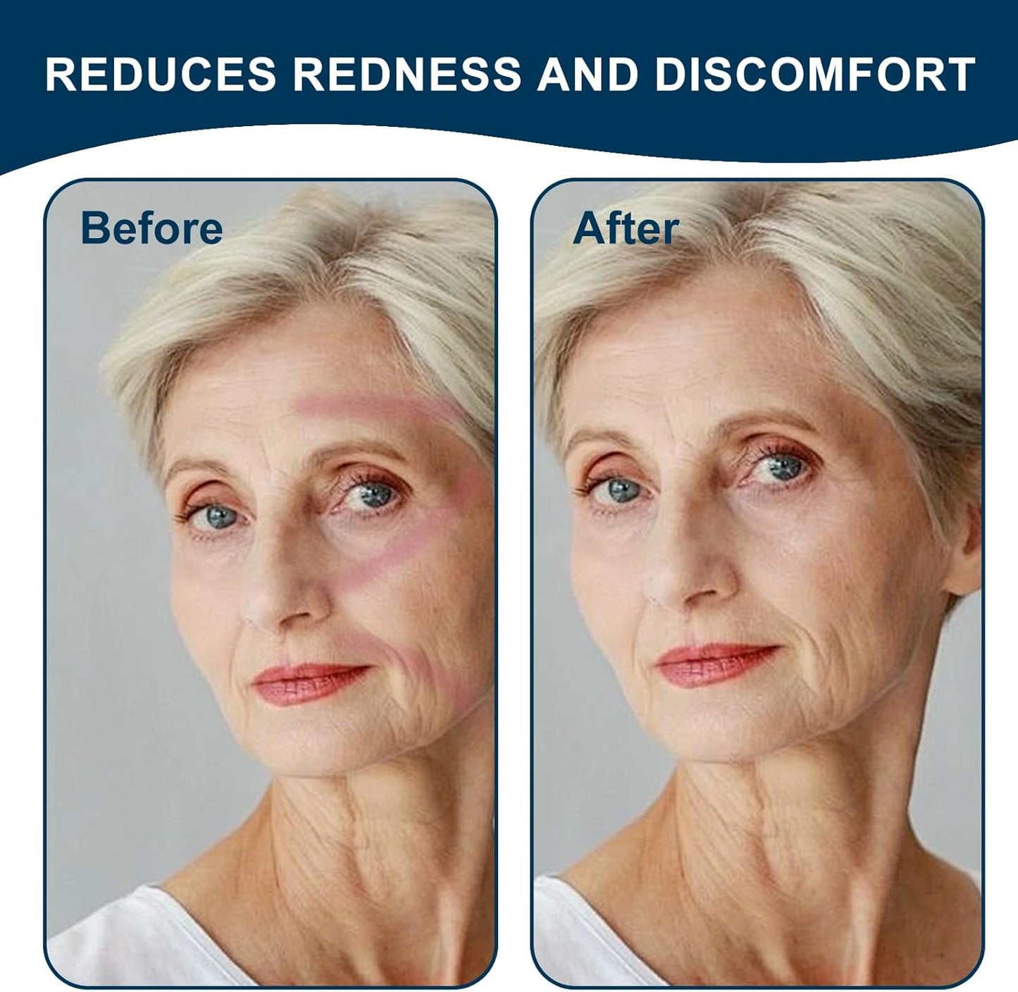 6 Pack Satin Strap Covers Breathable Strap Cushions Work for Most Headgear Straps Can Reduce The Tracks On The Face Made of Soft Fabric Face Pads (Blue/Green)