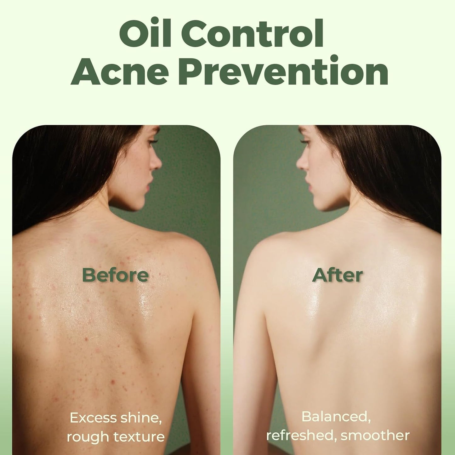 Tea Tree Soap, Handmade Soap Bar for Face and Body, Cold Process, Soothing Hydrating Body Wash for Clear Healthy Skin 8 Ounce