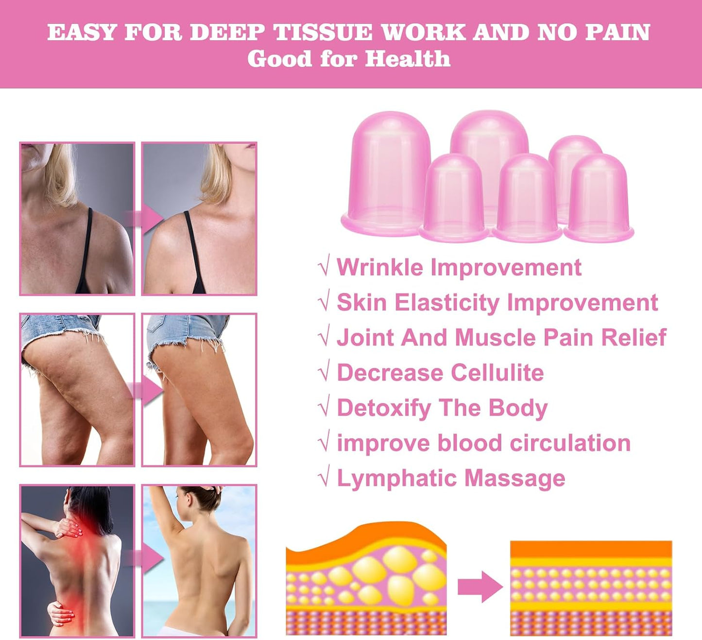 Silicone Cupping Therapy Set - Cupping Kit for Massage Therapy - Cellulite Remover Cupping Set - Anti Cellulite Cup Massager, Vacuum Suction Massage Cups for Cellulite Reduction