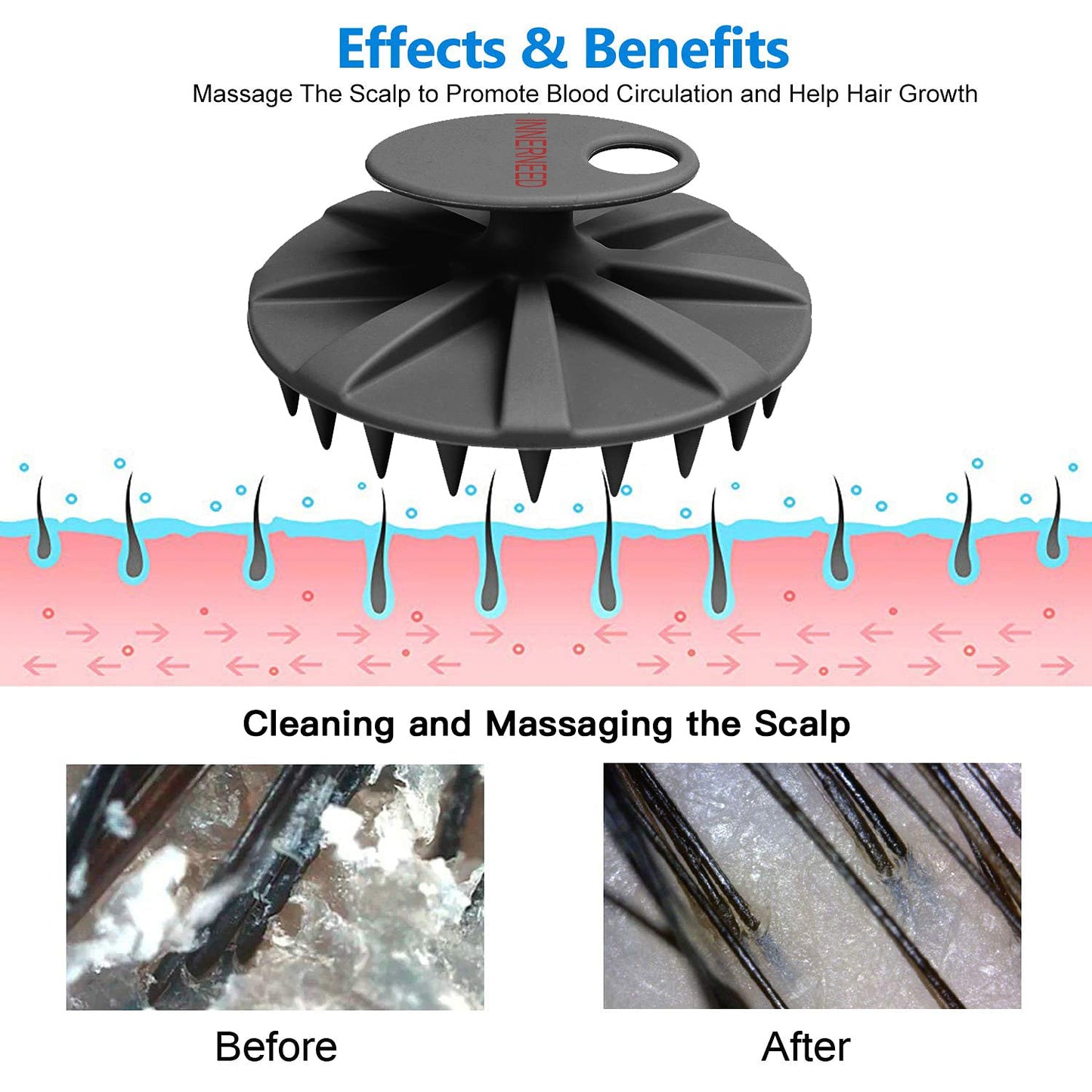 INNERNEED Scalp Massager Shampoo Brush, Wet & Dry Manual Scalp Care Head Scrubber Hair Washing, Soft Silicone Bristles, for Hair Growth, Dandruff Removal (Pack of 4)