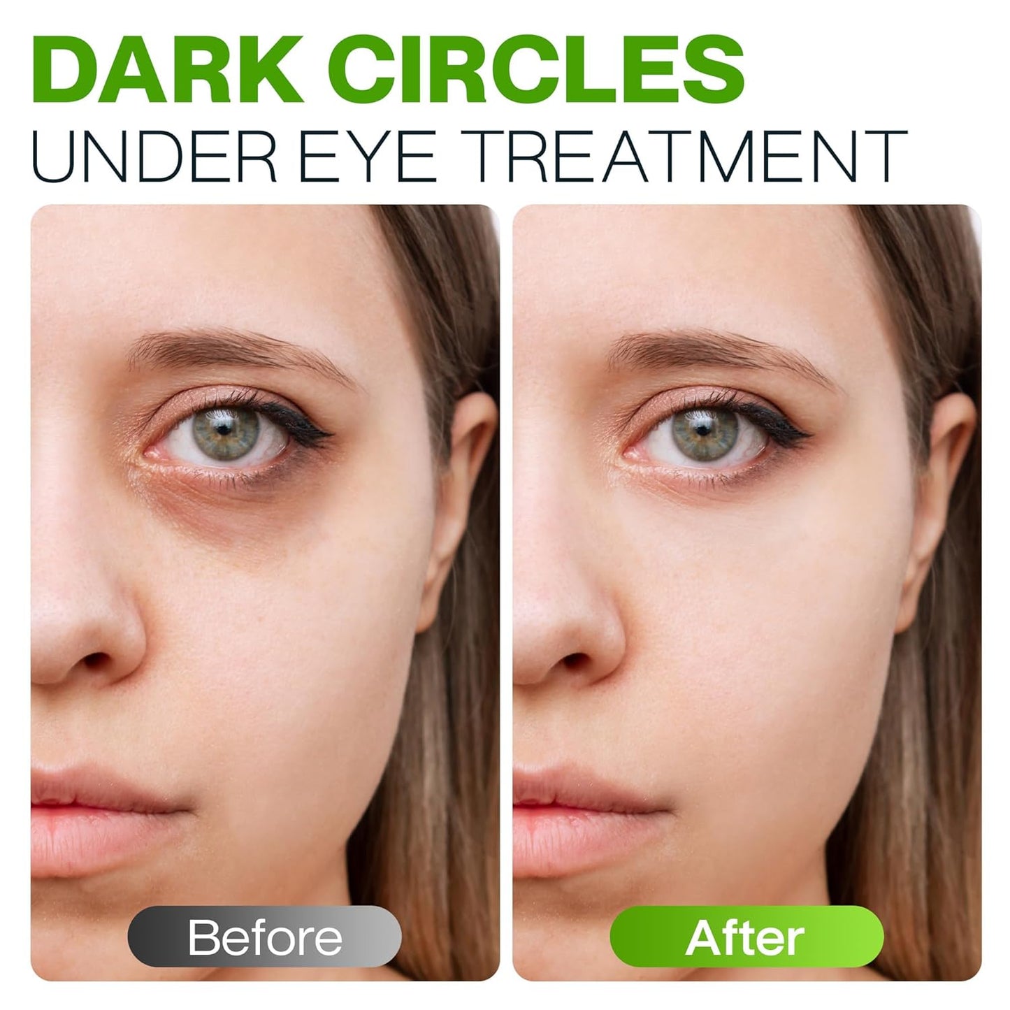 Peptide Eye Cream Anti Aging, Hydrating Under Eye Cream For Women & Men Dry, Sensitive or Mature Skin Repair, Daily Day & Night Treatment for Fine Lines, Wrinkles, Dark Circles, Bags, Puffiness 0.5 Oz