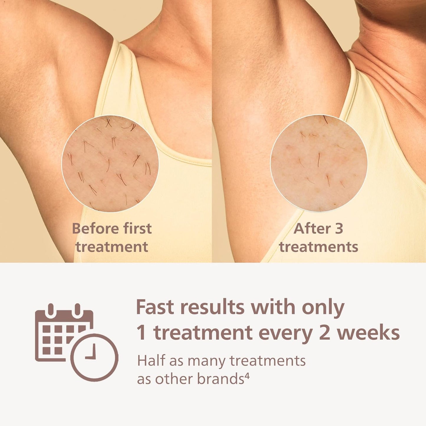 Philips Lumea 9000 Series IPL Hair Removal Device - Permanent Visible Hair Reduction Done at Home, SenseIQ Technology, 4 Attachments for Body, Face, Bikini & Underarms, for Women & Men, BRI984/03