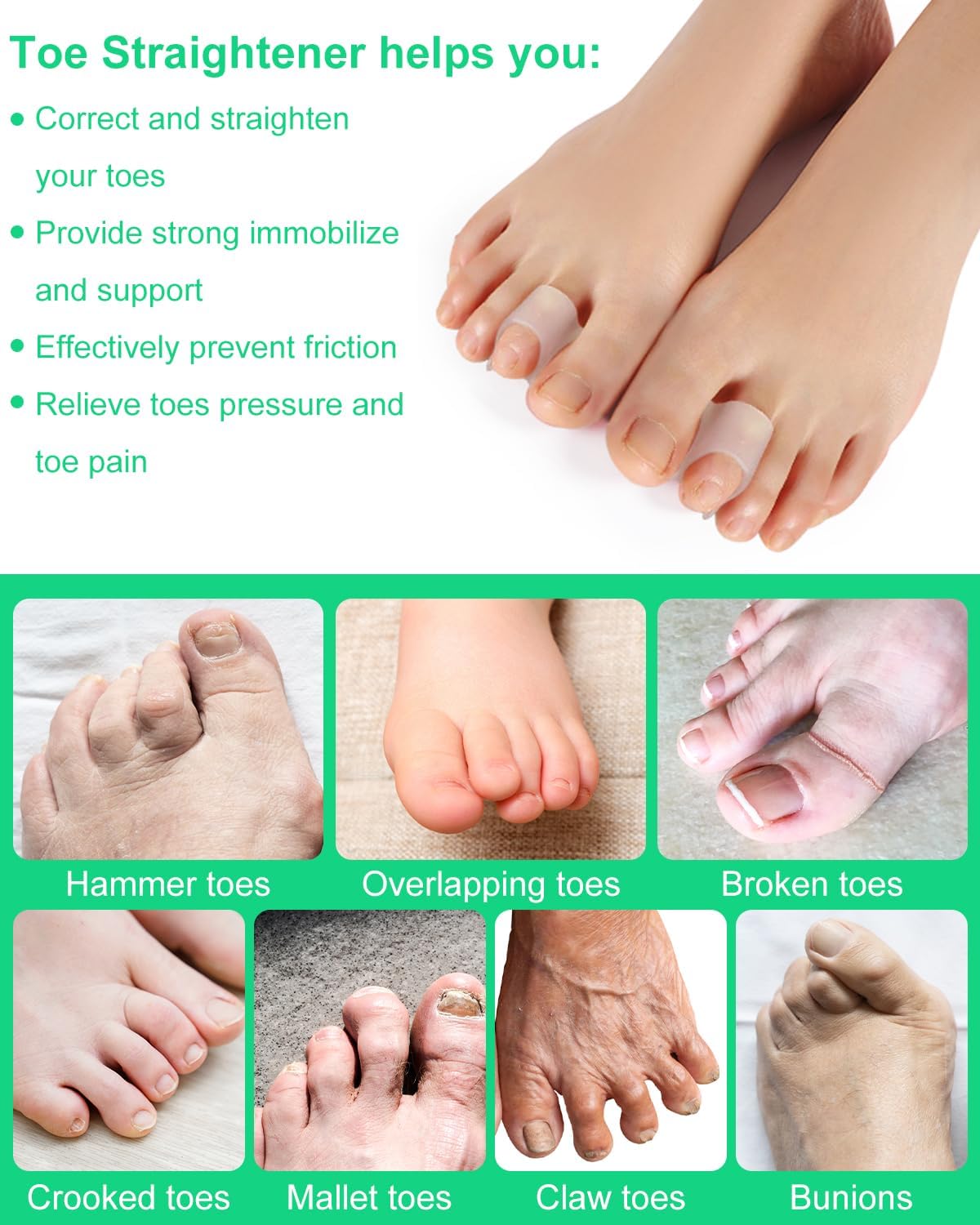 10Pcs Hammer Toe Corrector Straighteners for Women and Men Curled Toes, Crooked, Claw, Hammertoe, Gel Toe Splints for Straightening, Silicone Foot Bunion Spacer Separators (Small)