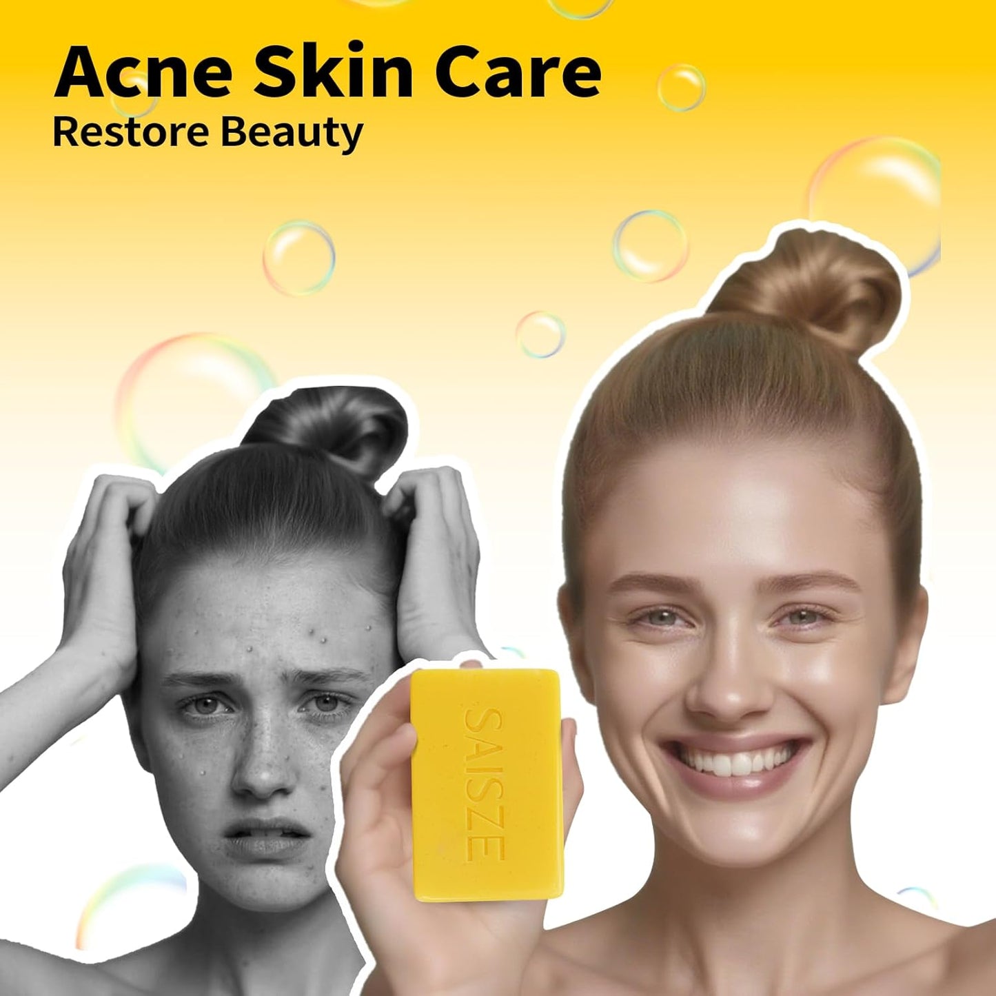 Dead Sea Sulfur Soap Bar Help with Acne and Blackheads, Natural Sulfur Face Wash Bar Keeps Pores Cleaner, Organic Sulphur Soap Bar for Oily Skin and Blemishes, 4 Ounce (Pack of 2)