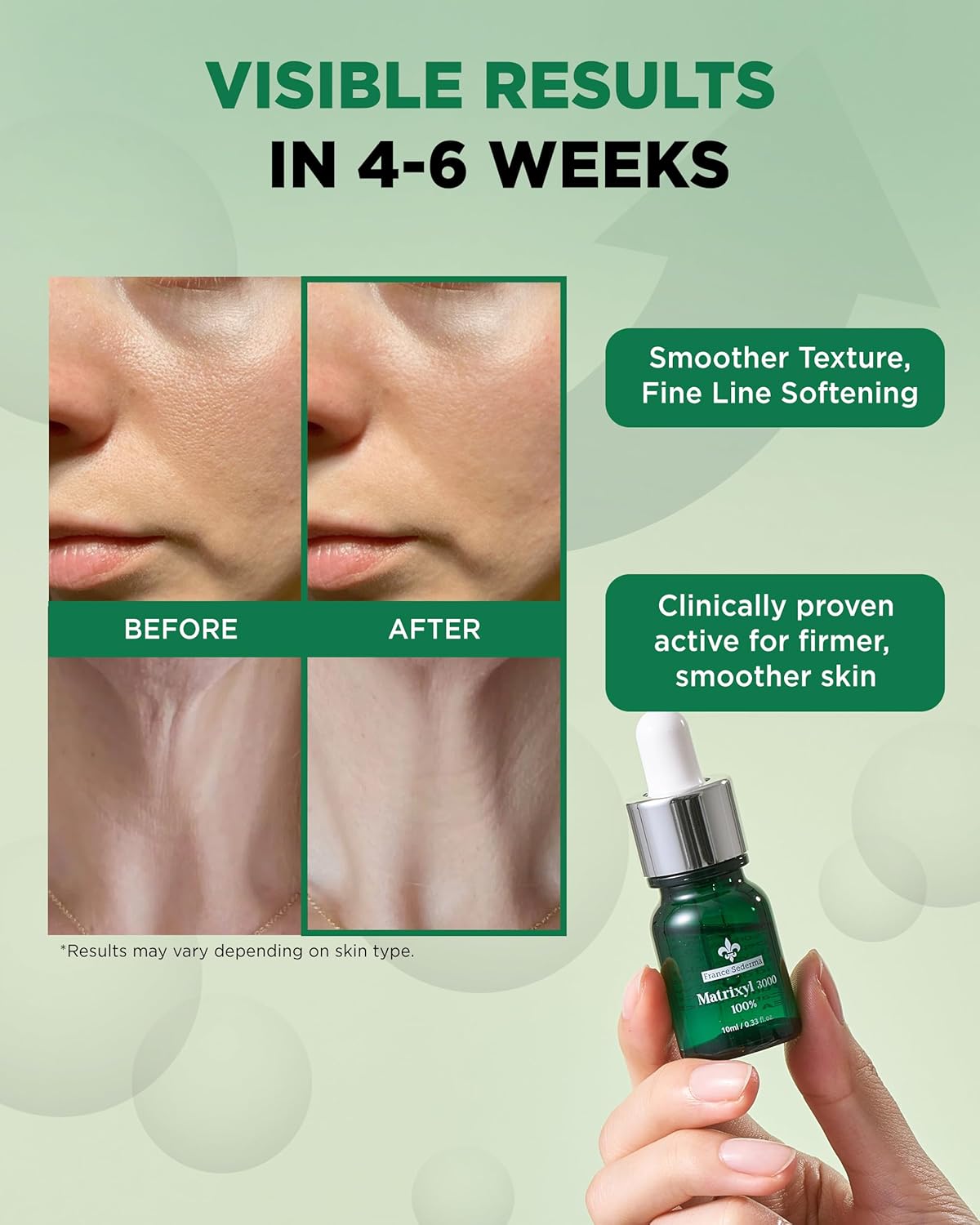 Matrixyl 3000 100% Serum Skincare – Pure Peptide Complex Anti-Aging Facial Ampoule from France Sederma, Collagen Boosting Wrinkle Treatment, Perfect for Layering & DIY, 0.33 fl.oz (10ml) 2 Pack