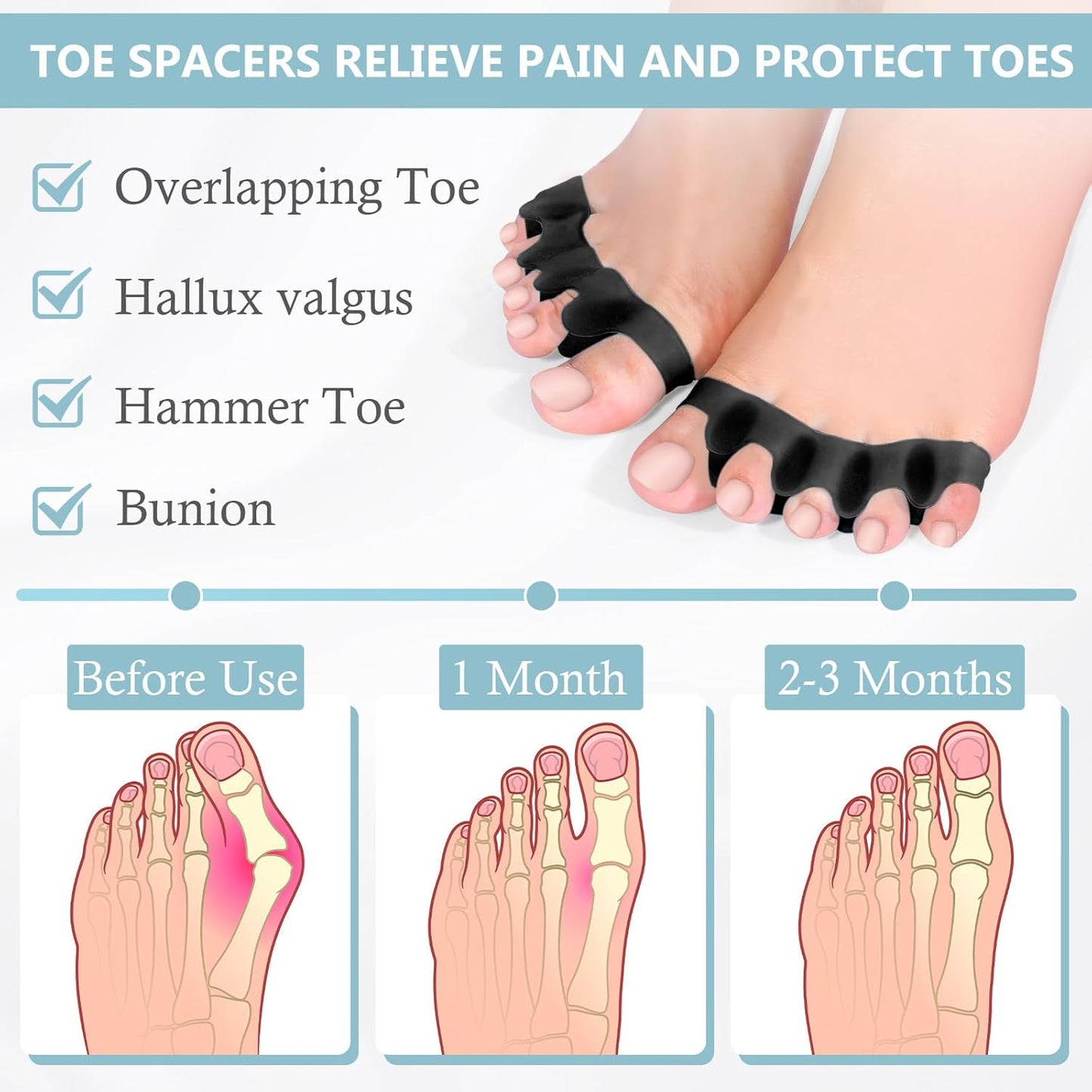 2PCS Toe Separators for Women and Men, Gel Toe Spacers for Pedicure and Foot Alignment, Comfortable Foot Care for Bunions and Overlapping Toes