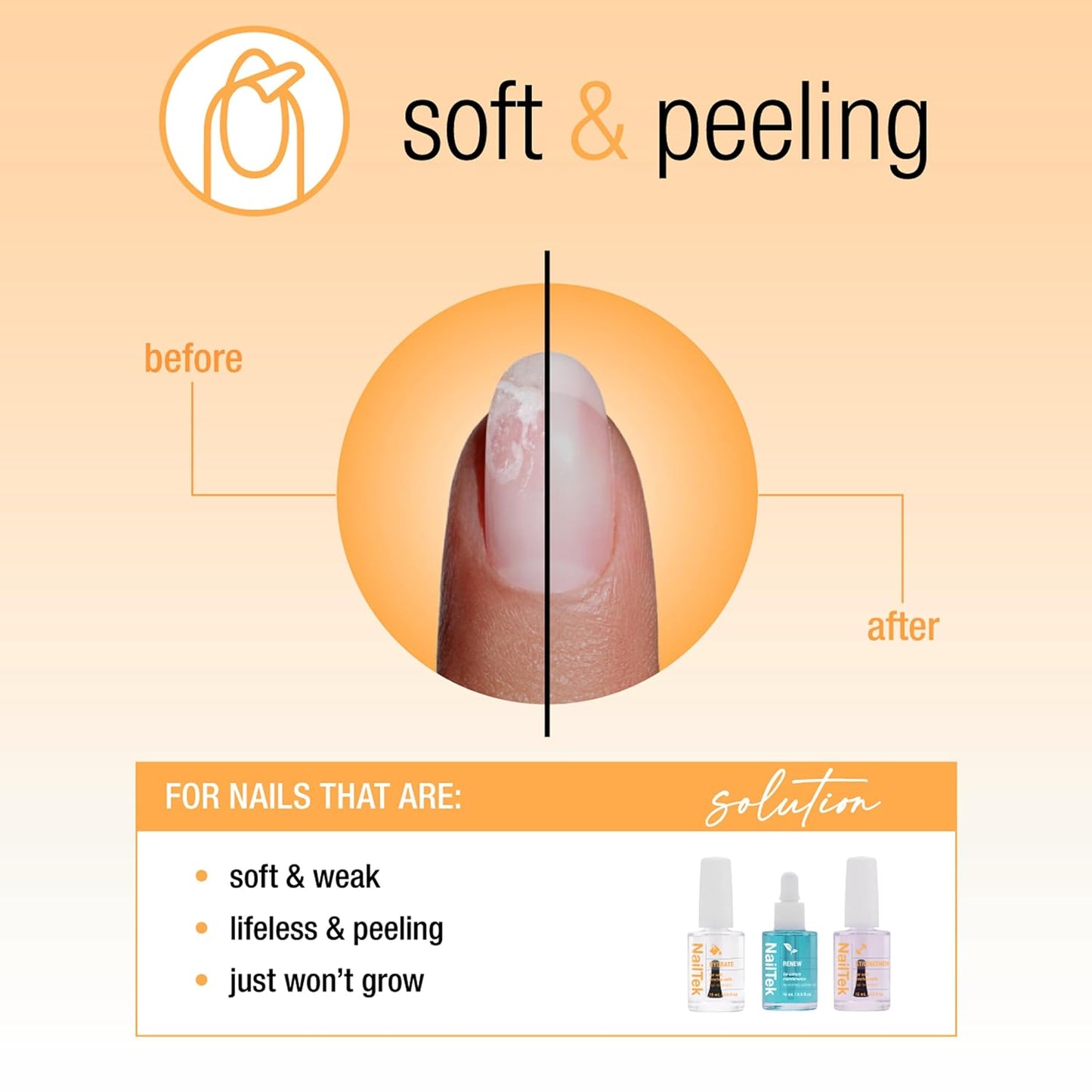 Nail Tek Recovery Kit – Nail Repair for Damaged Nails, Hydrate, Renew, & Strengthen Nails Treatment, Made in USA, 0.5 fl oz each