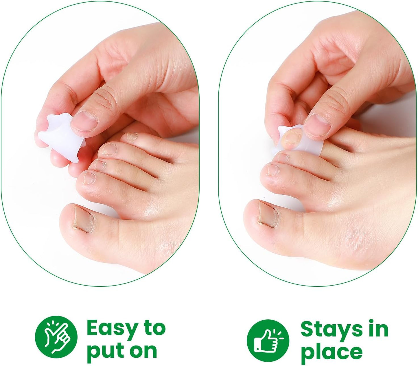 Bukihome Hammertoe Corrector - 6 Pack Toe Splints - Soft Gel Toe Straighteners - Realign Bent, Curled, Crooked, Claw, Hammer Toes - Toe Corrector for Men and Women, Small Sizes (White)