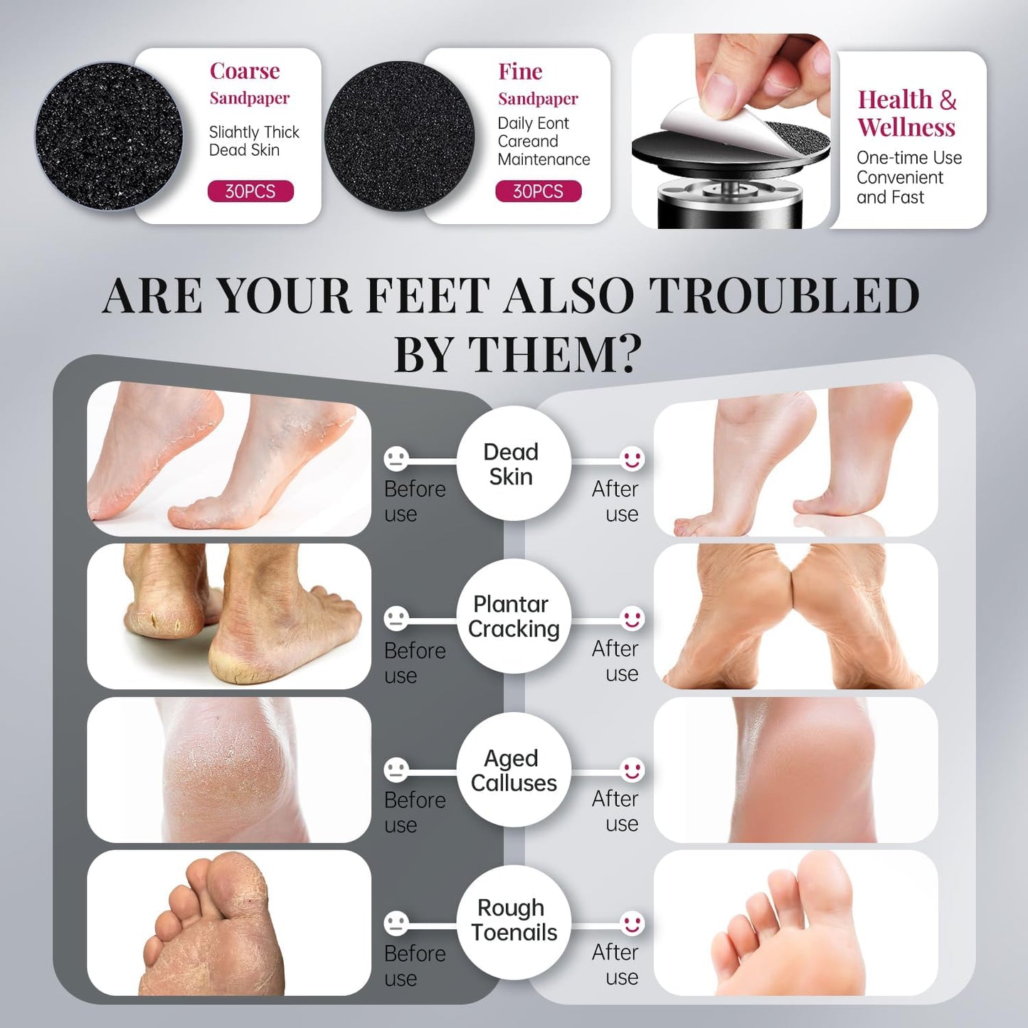 krofaue 1000RPM Electric Callus Remover - Professional Aluminum Foot File Adjustable Pedicure Tool with 60pcs Sandpaper Discs for Dead Skin at Home