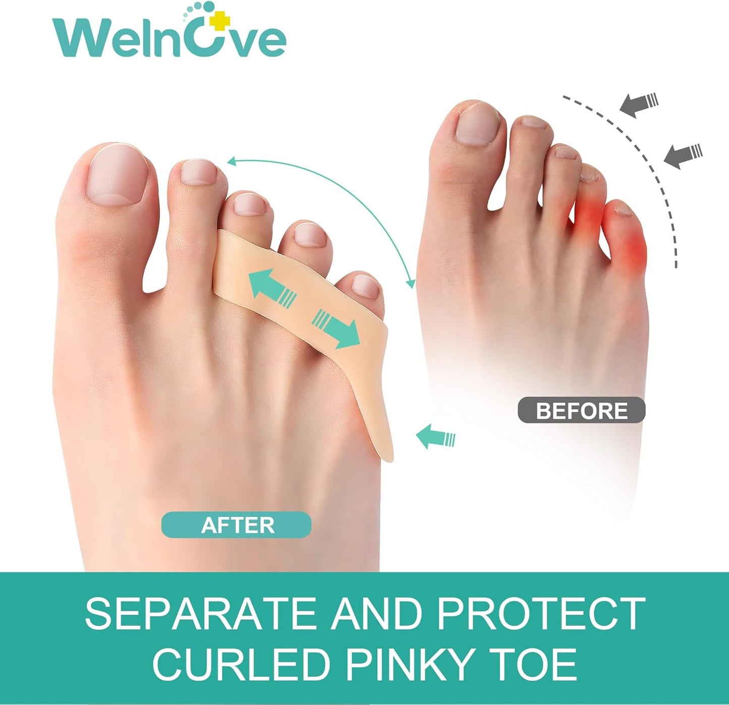 Welnove Gel Pinky Toe Separators - 8 Pack Pinky Toe Spacers, Bunion Cushions Pads for Women＆Men, Silicone Little Toe Protectors for Preventing Rubbing & Relieve Pressure - FSA/HSA Eligible (Beige)