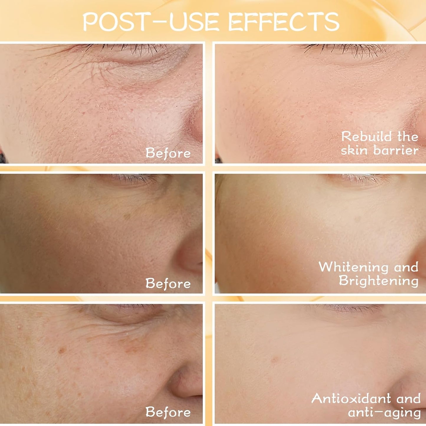 Dr. Yiman Vitamin C and Retinol Facial Essence Set - Anti-Aging Essence Liquid, Brightening and Anti-Wrinkle Set,use for day and night.