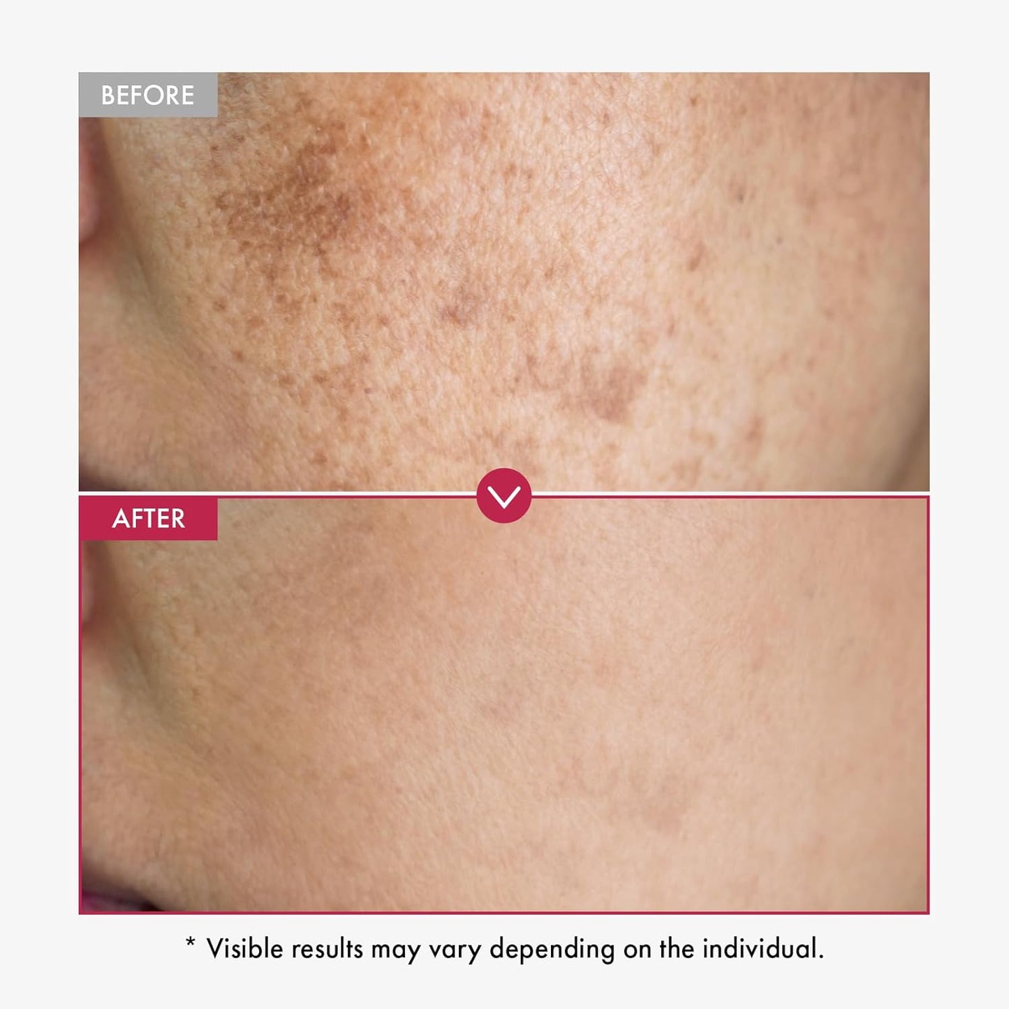 TOSOWOONG Niacinamide 10% + Tranexamic Acid 4% Serum, Arbutin 2%, Hyaluronic Acid, TXA Facial Serum, Glass Skin, Clarifying, Radiant Complexion with Natural Color, Korean Skin care, 33ml, 1.11 fl.oz.