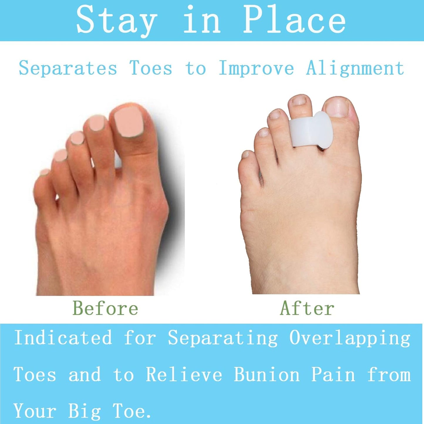 Pack of 12 Gel Toe Separator, (1/4" Thick) Big Toe Spacers, Single Loop Toe Spreader for Bunions, Overlapping Toe, Corrector and Spacer (White)