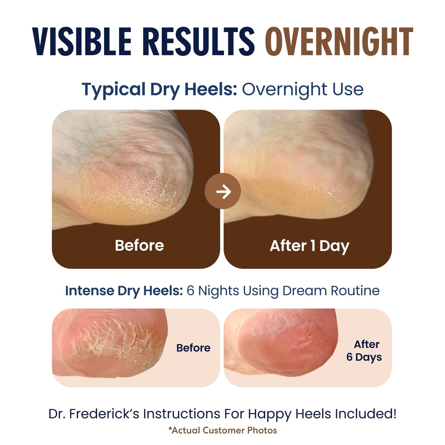 Dr. Frederick's Original Moisturizing Heel Socks for Cracked Heel Treatment - 2 Pairs - Socks for Dry Feet - Cracked Skin Repair & Overnight Hydration - Foot Care for Women & Men - Shea Butter