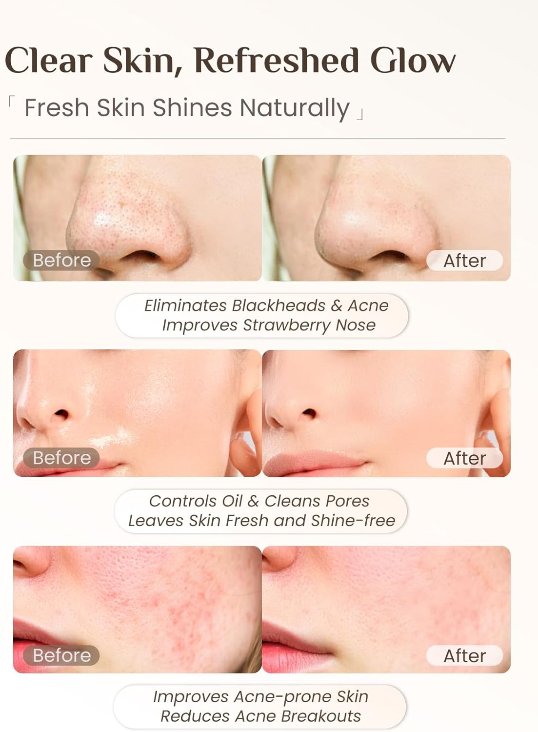 Rena Chris 3 Pcs Silicone Face Scrubber, 3 in 1 Face Mask Applicator & Facial Cleansing Brush, Pore Brush for Exfoliating, Blackhead, Skincare Applicator Tools