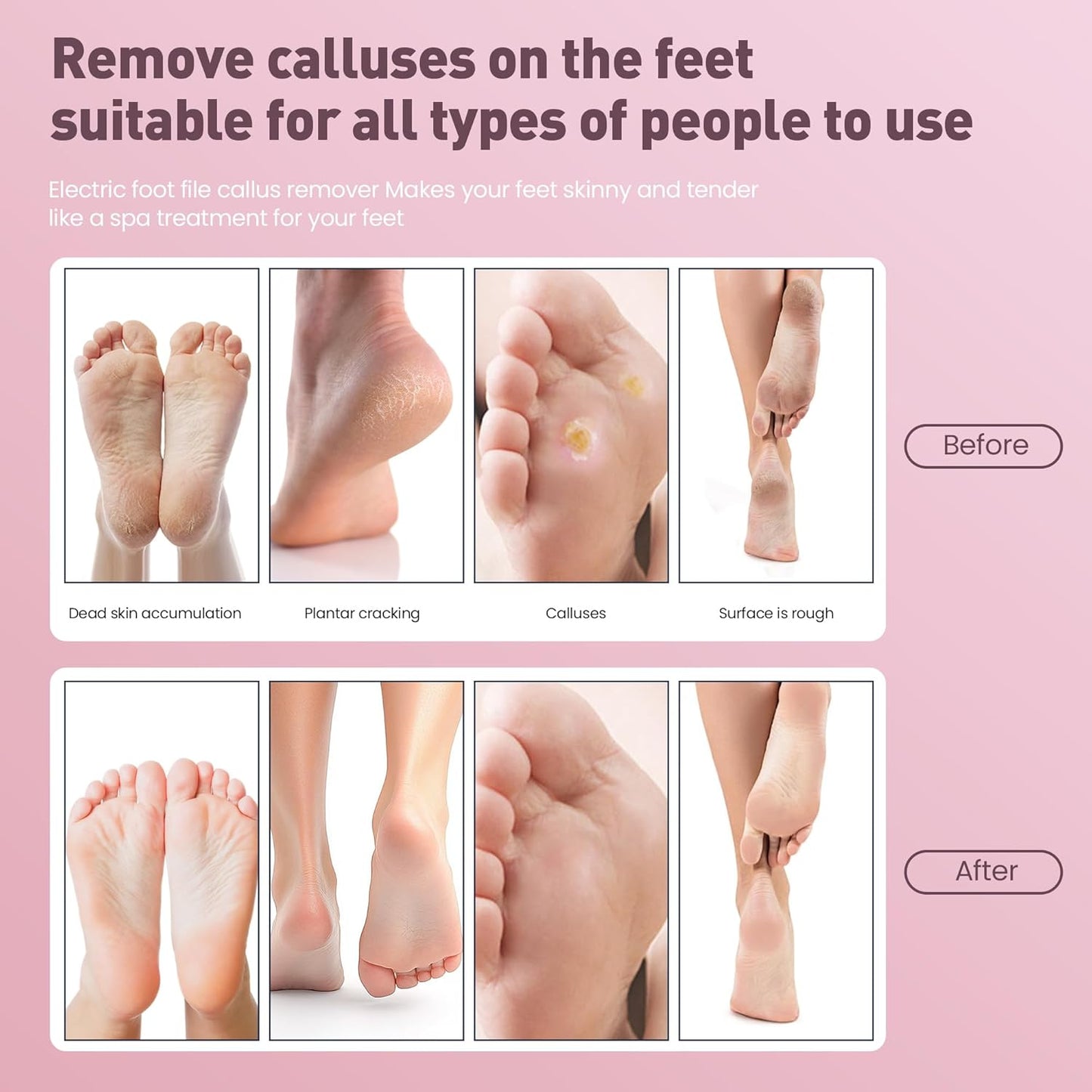 Electric Foot Callus Remover,2 in1 Rechargeable Callus Remover for Feet,9-Speed Cordless Electric Foot File Nail Grinder,Foot Scrubber Pedicure Tools for Dead Skin Dry Cracked Feet(Pink MINI)