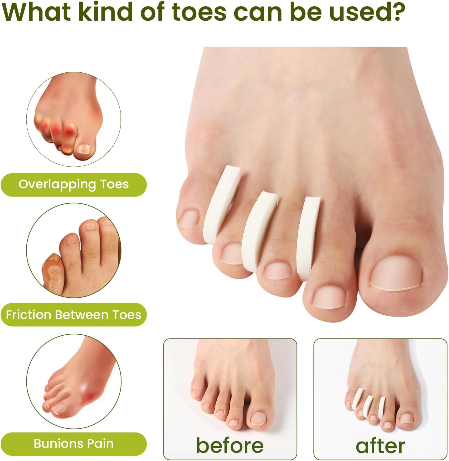 Bukihome 50 Pack Foam Toe Separators - Correct Overlapping Toes and Reduce Friction - Breathable and Comfortable, Foam Toe Spacers for Women