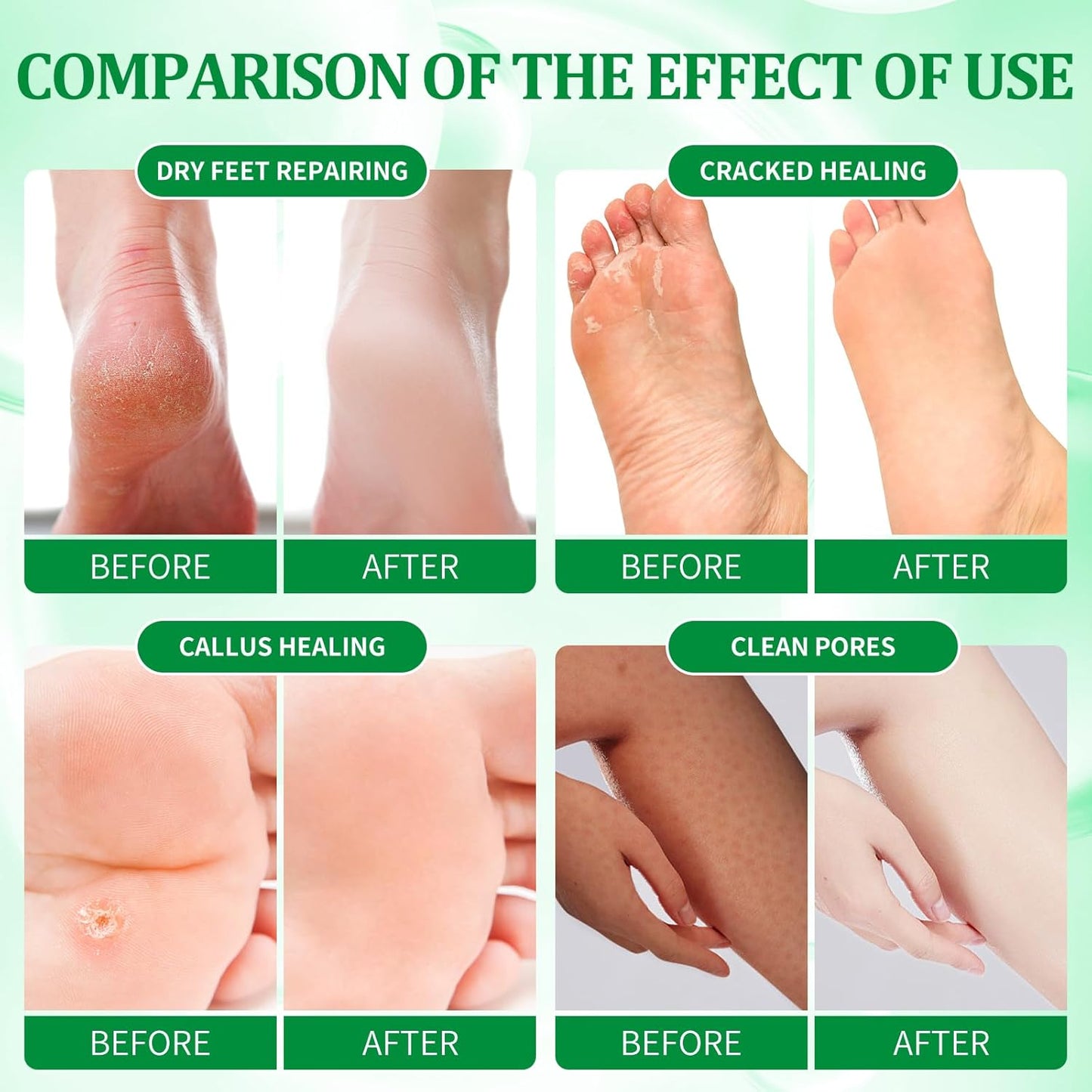 Pedicure Kit Foot Soak Set: Bubble Salt, Sugar Scrub, Massage Mask, Massage Lotion in a Box, 4 Step Foot Spa Kit for Dry Feet, Calluses and Tired Feet (1 Set Green Tea)