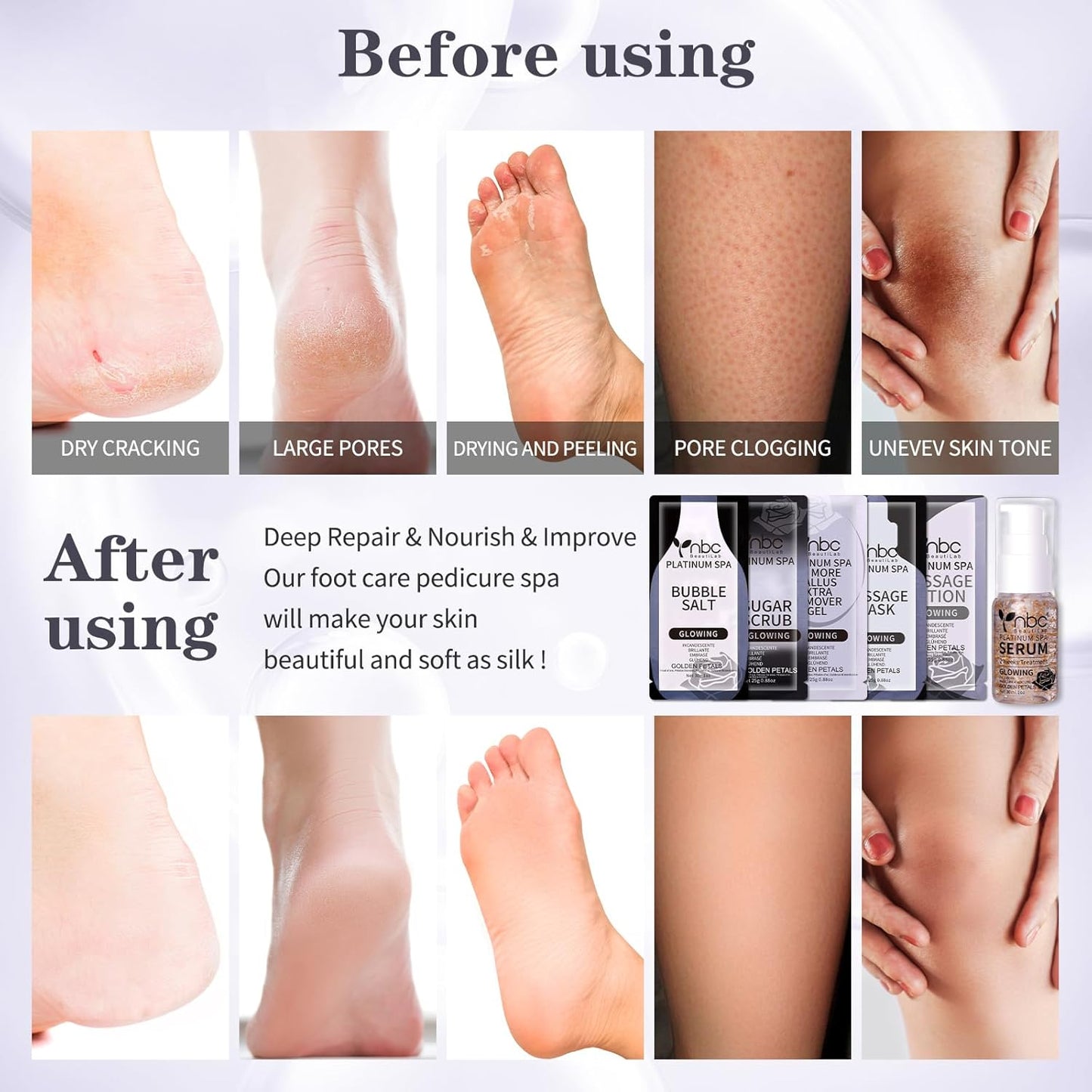 Pedicure Foot Soak Set - Upgraded 6 in 1 Foot Spa, Foot Bath Spa, Pedicure Kit, Foot Soak for Tired & Dry Cracked Feet, Athletes Feet, Bad Odor, Softens Calluses,Golden Petals