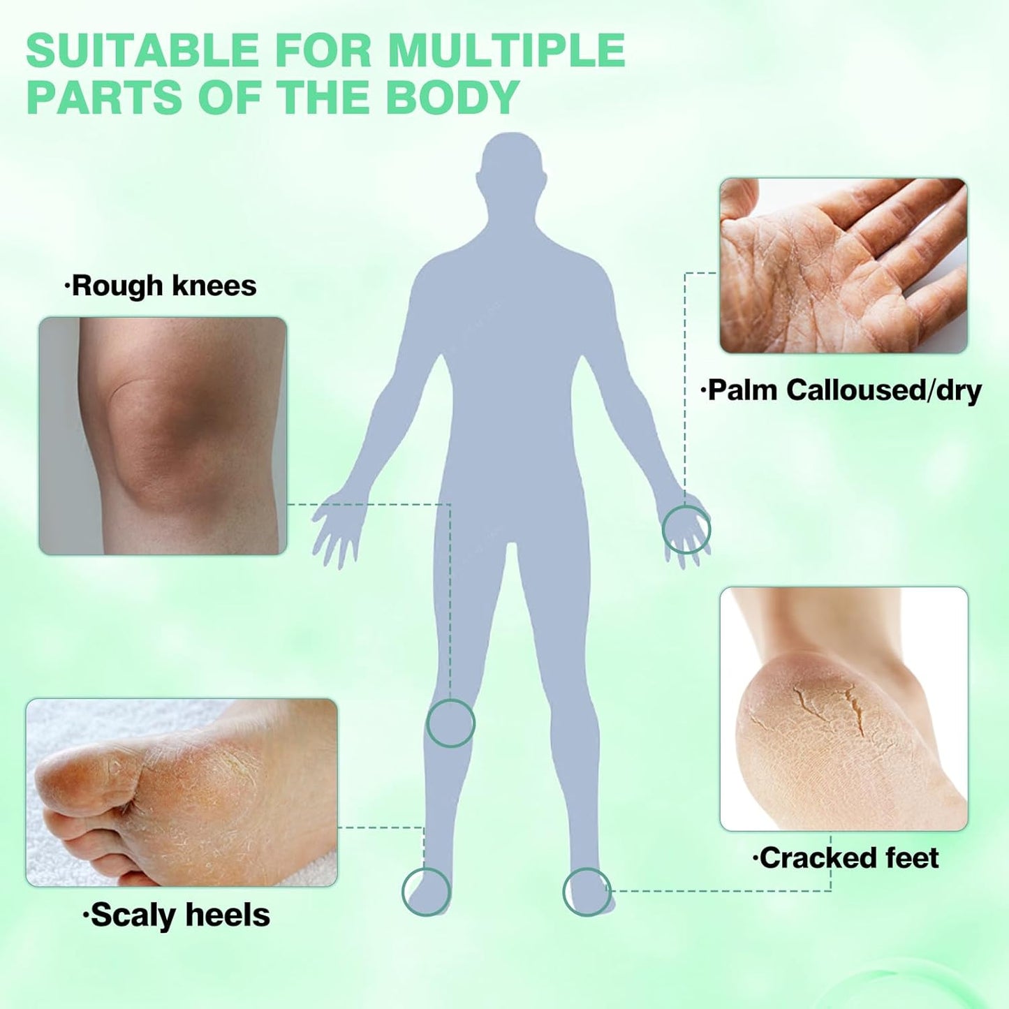 Peppermint Oil Foot Cream for Dry Cracked Heels and Feet, Ultra-Hydrating Softening Foot Cream, Moisturizes for Healthy Feet, 2.5 oz