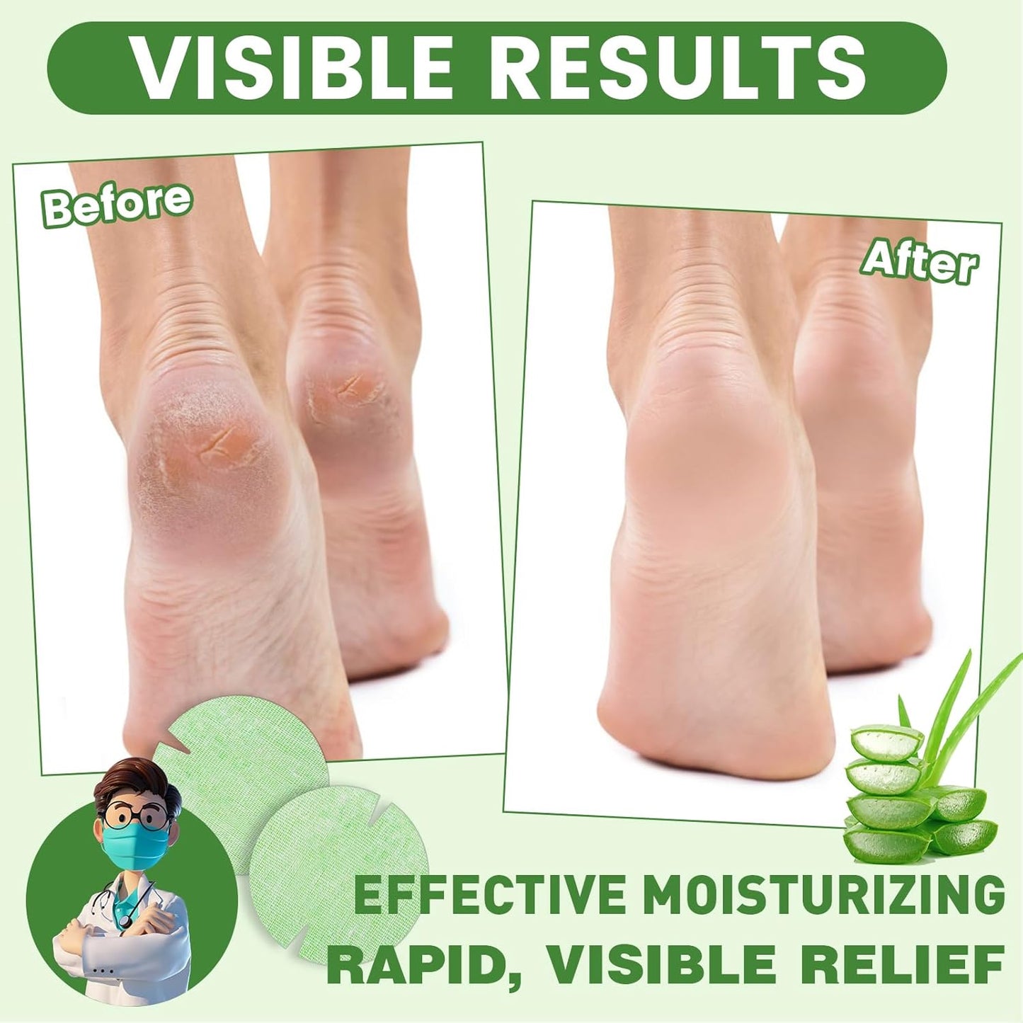30PCS Patented Aloe Vera Cracked Heel Treatment Patches, Cracked Heel Repair Bandage