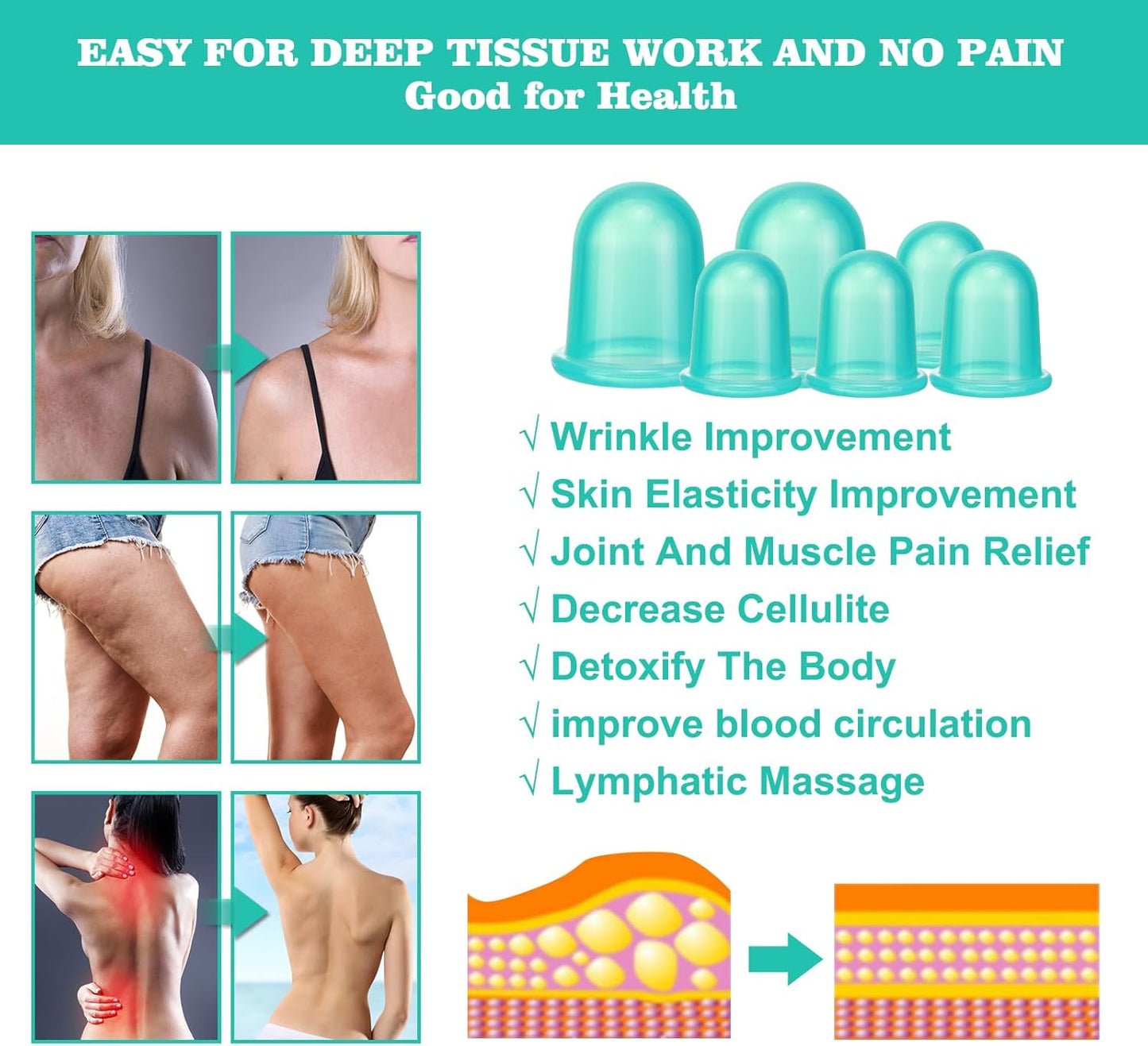 Silicone Cupping Therapy Set - Cupping Kit for Massage Therapy - Cellulite Remover Cupping Set - Anti Cellulite Cup Massager, Vacuum Suction Massage Cups for Cellulite Reduction