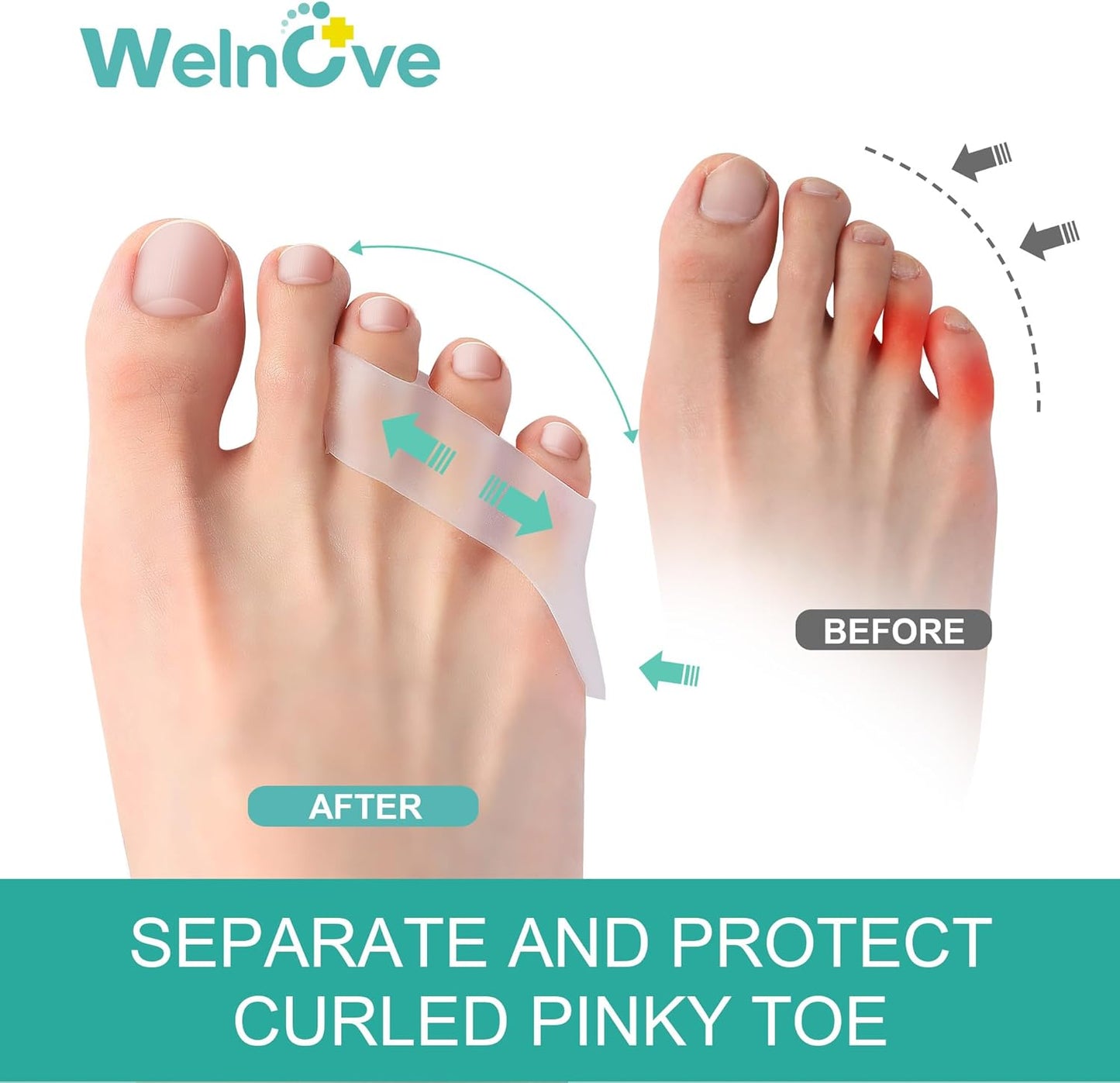 Welnove Gel Pinky Toe Separators - 8 Pack Pinky Toe Spacers, Bunion Cushions Pads for Women＆Men, Silicone Little Toe Protectors for Preventing Rubbing & Relieve Pressure(Clear)