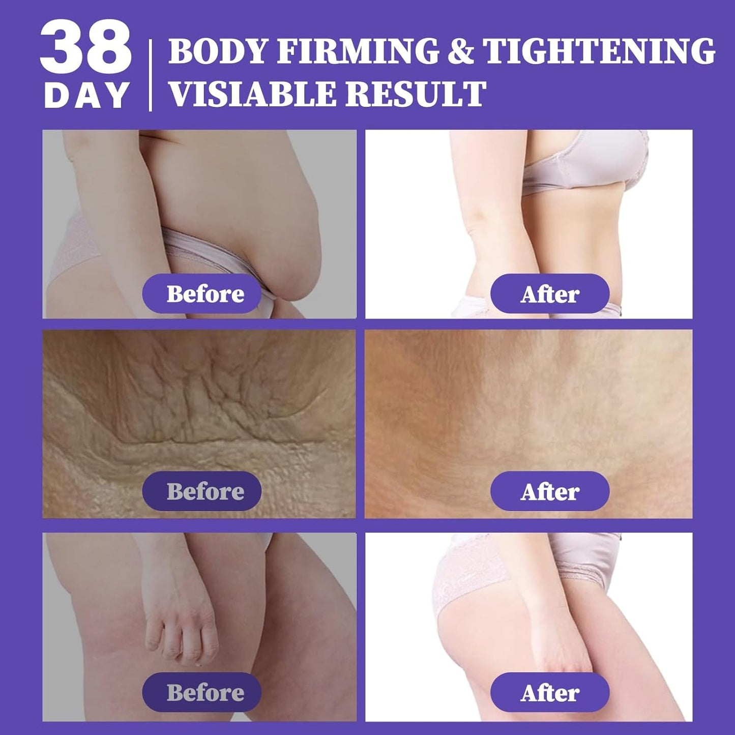 BE-Dreamy Overnight Toning Whip With Collagen, Get Body Firming Cream Cellulite Remover, Skin Tightening Cream For Body Helps To Tone And Firm While You Sleep| All Skin Types 200ML/6.76FL.OZ