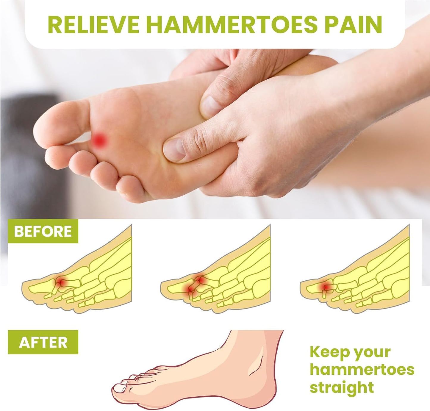 Bukihome Hammertoe Corrector Gel Toe Straighteners - 12 pcs Support Crest for Women & Men - Realign Bent, Crooked, Curled, Claw, Hammer Toes - White,Three Loop